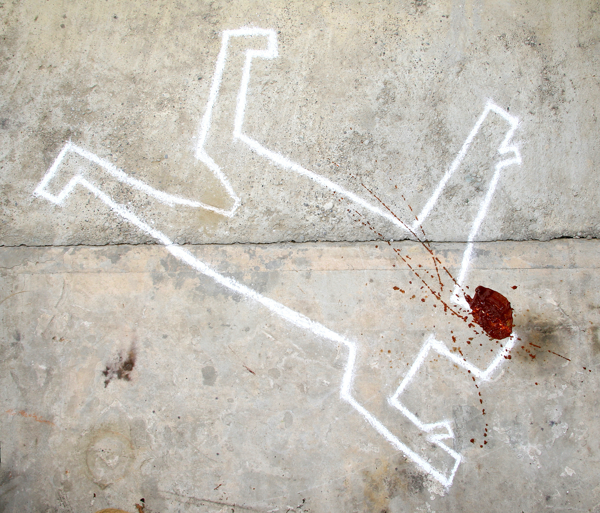 钢筋颅脑贯通伤病因