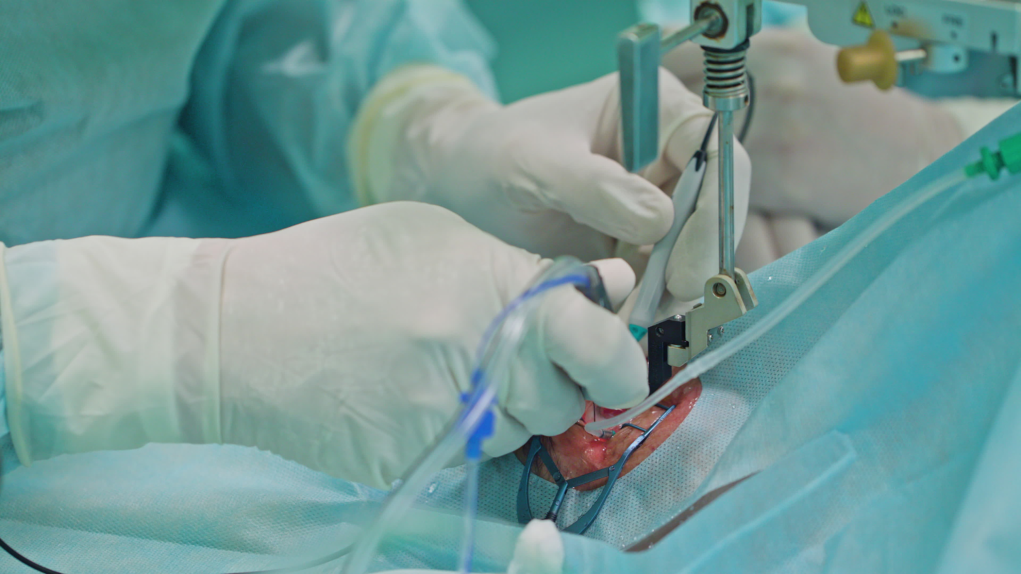 ophtalmology surgeons within the intervention