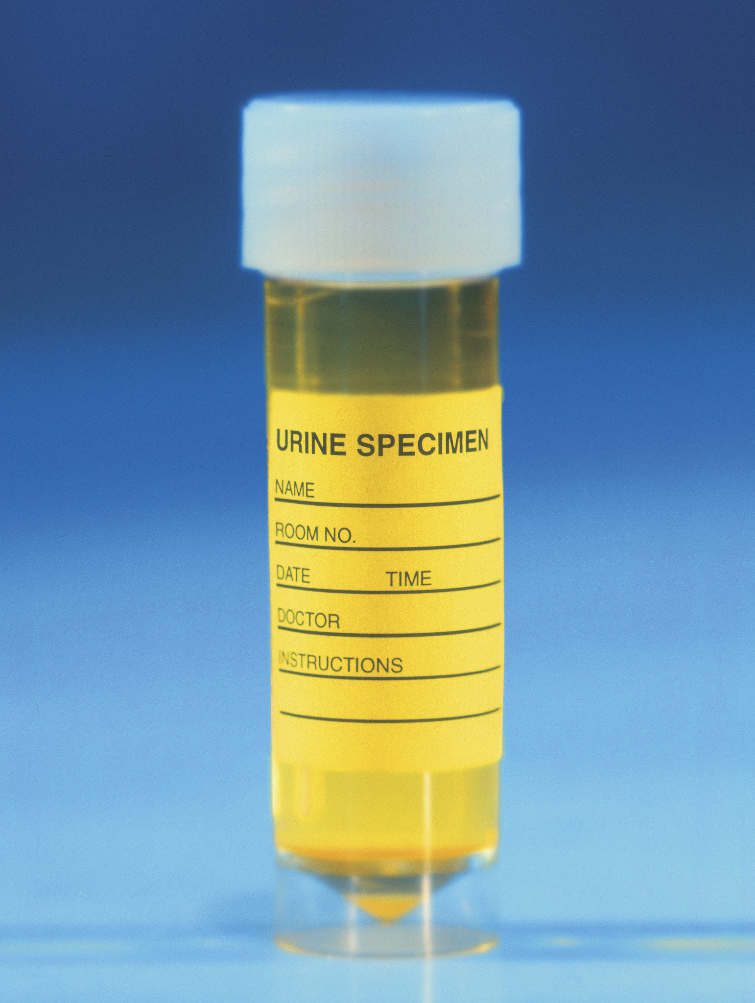 Explosion on Vessel Confined to Stern, No Oil Spills Reported