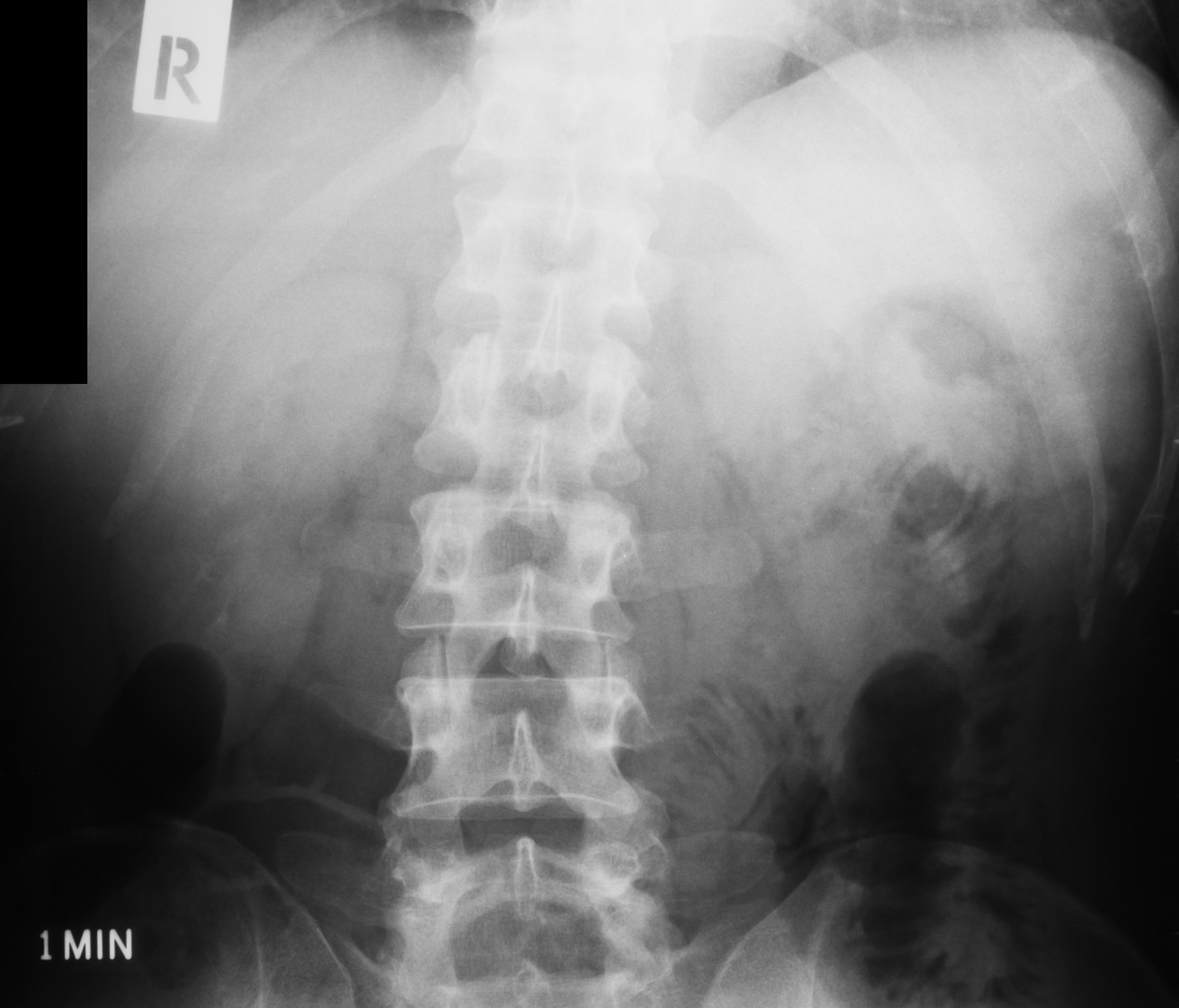R语言数据框筛选提取：根据G列值分类存储