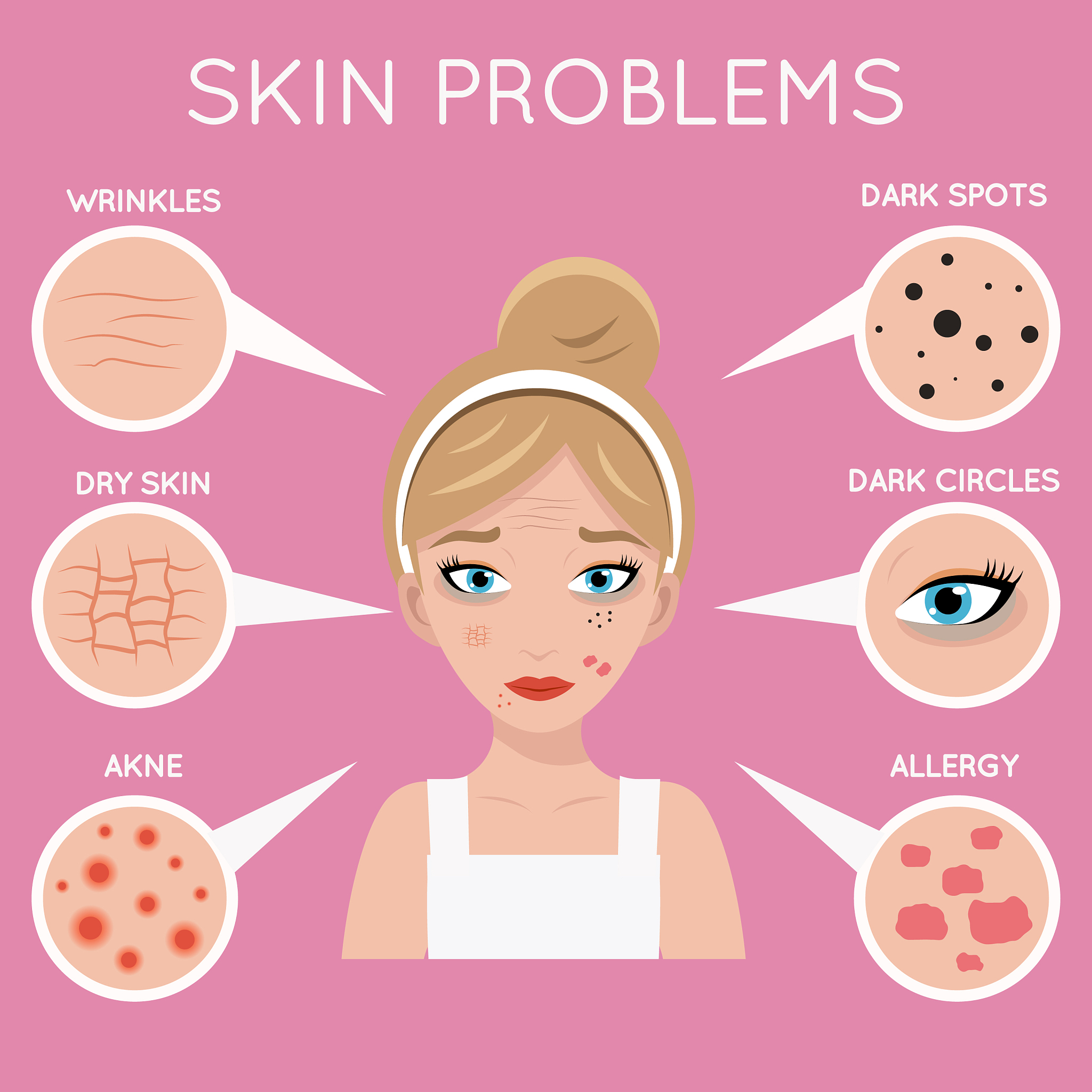 皮肤类型分类及保养指南：油性、干性、混合型、敏感性皮肤护理