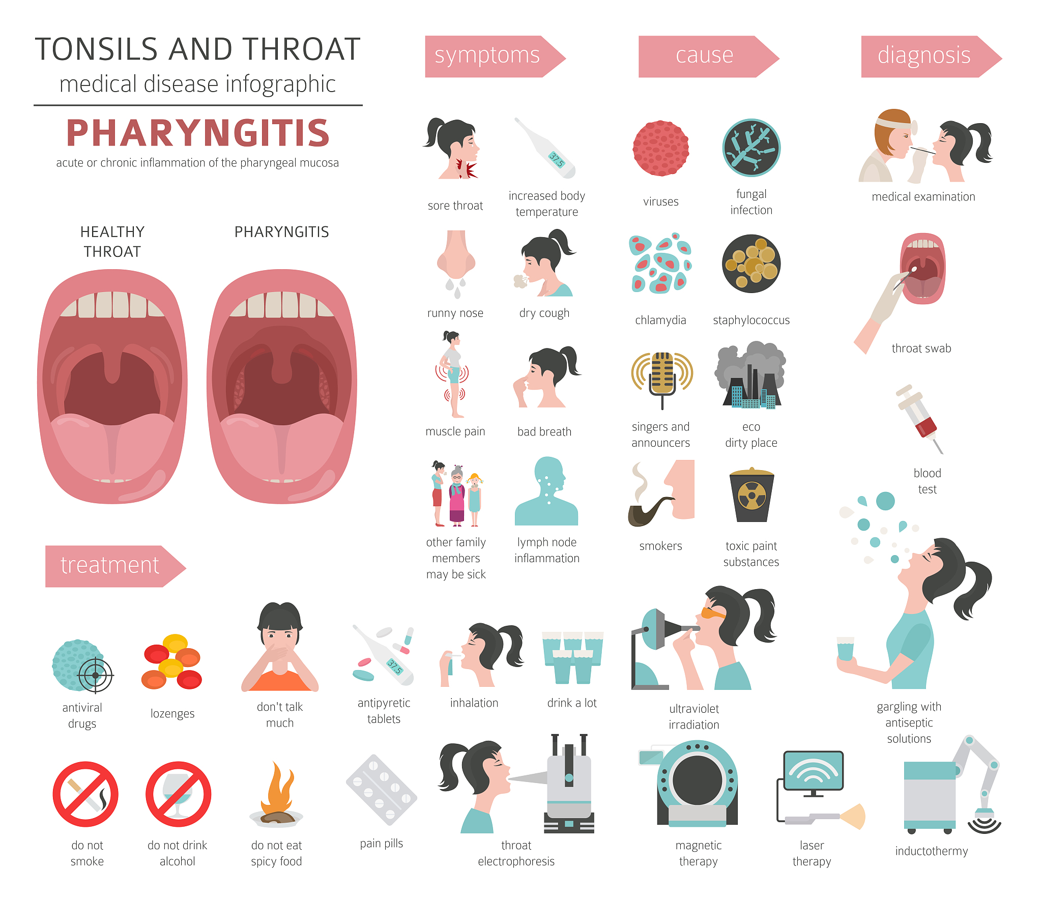 扁桃体发炎：病毒原因、发烧4天怎么办？