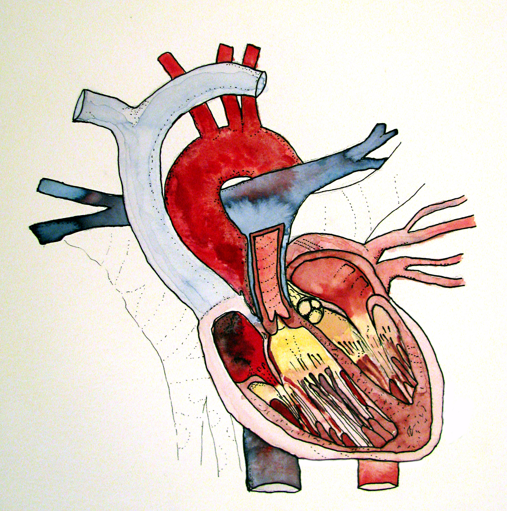 门脉阻断术：手术流程详解