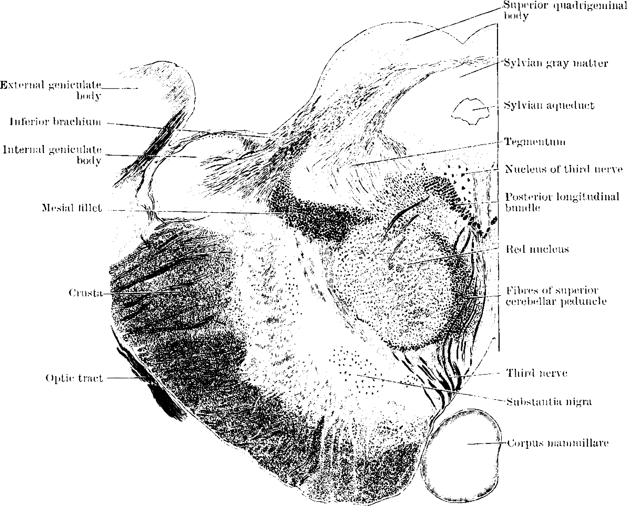 闭合性胸腹部损伤合并创伤性脾破裂腹腔镜探查备剖腹探查术的疼痛护理