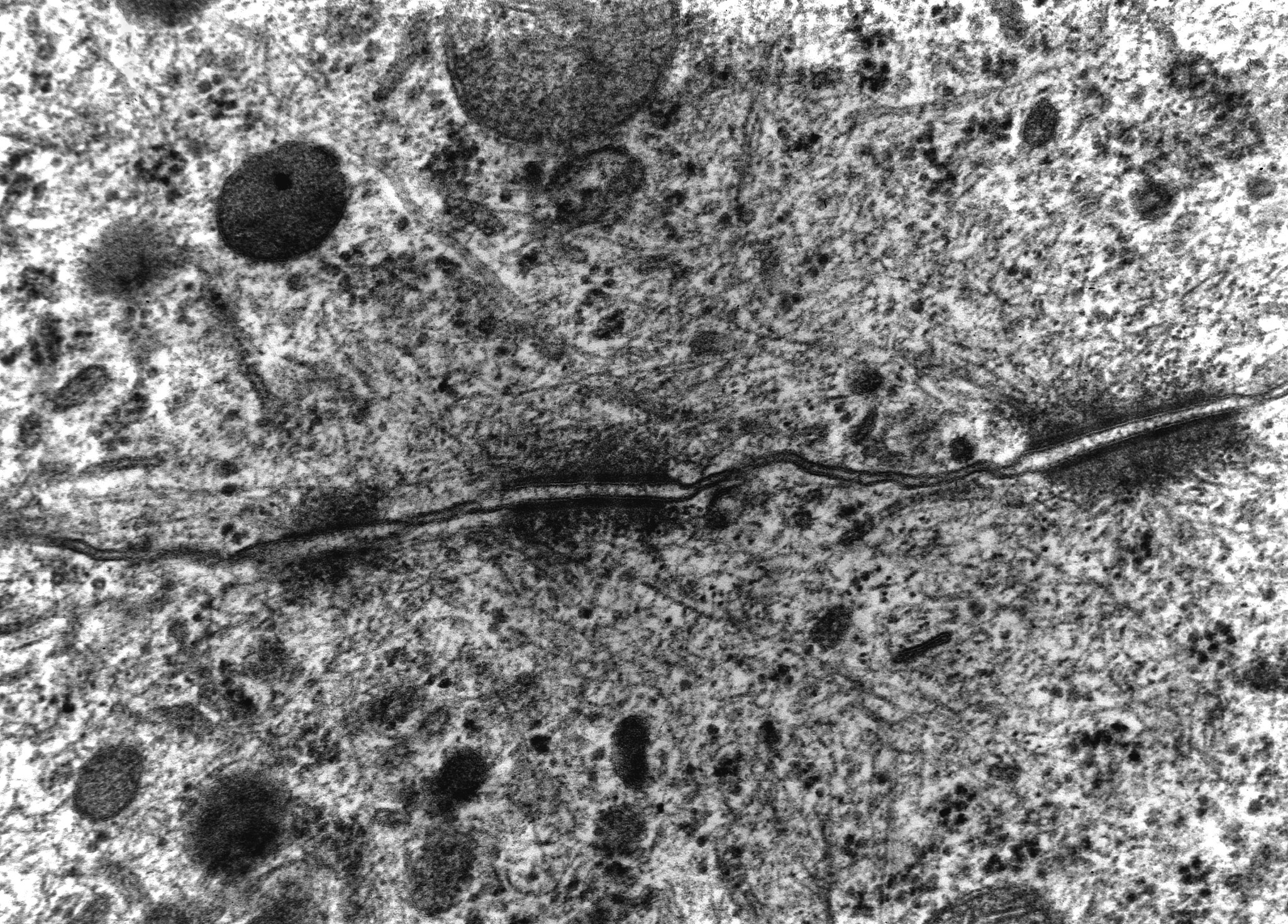 Scanning electron microscopy SEM is a microscopic morphological characterization method with advantages of largefield of viewhigh resolution and so on． In this paperthe principle of three common signa