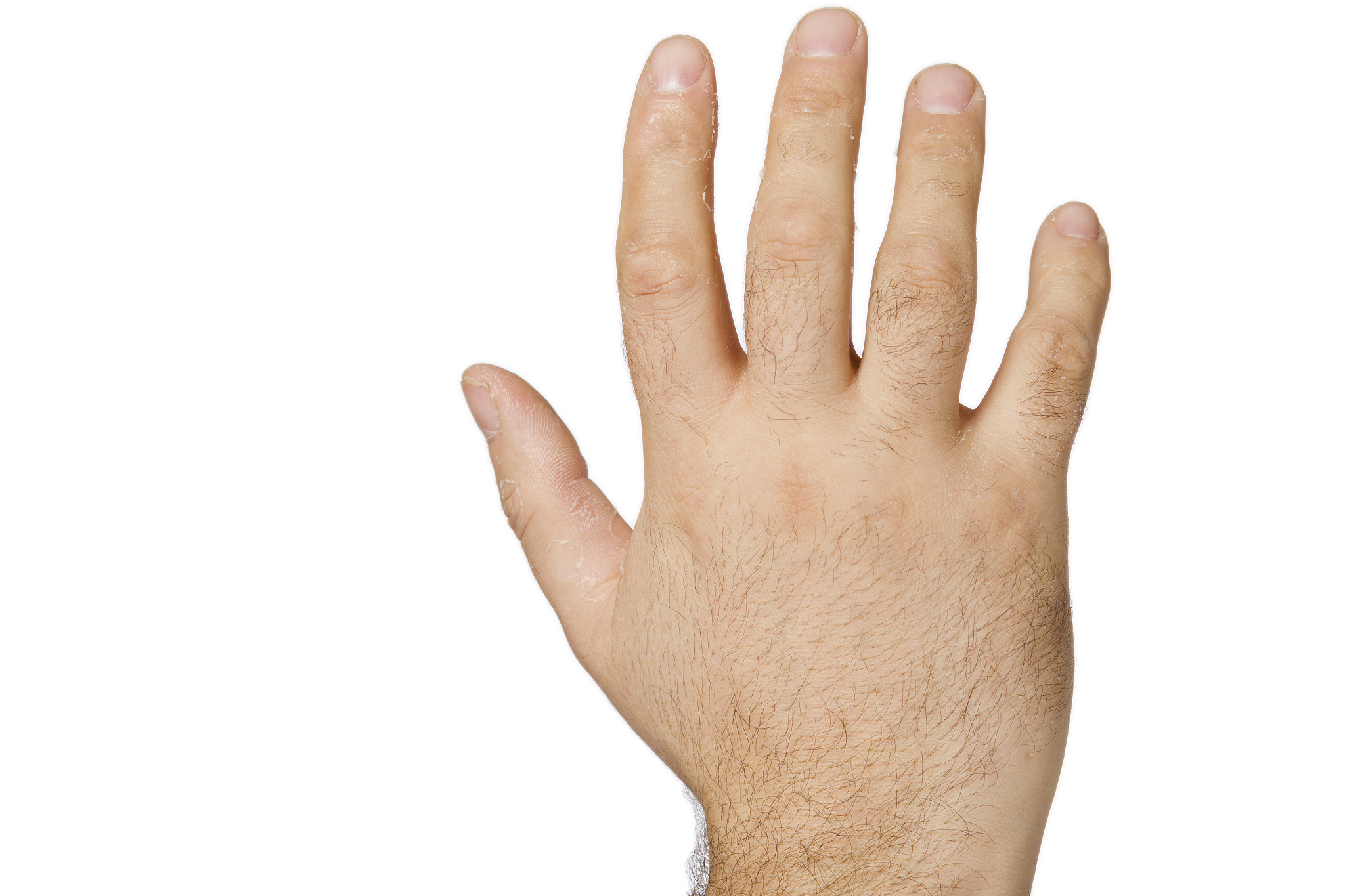 人手为什么会长老茧