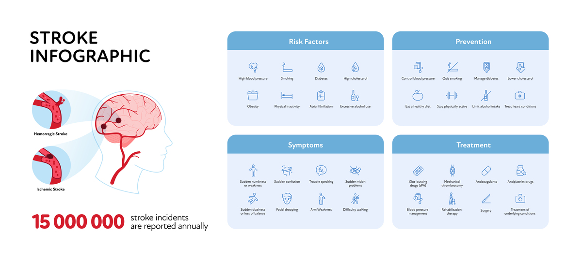 中风：症状、原因及治疗