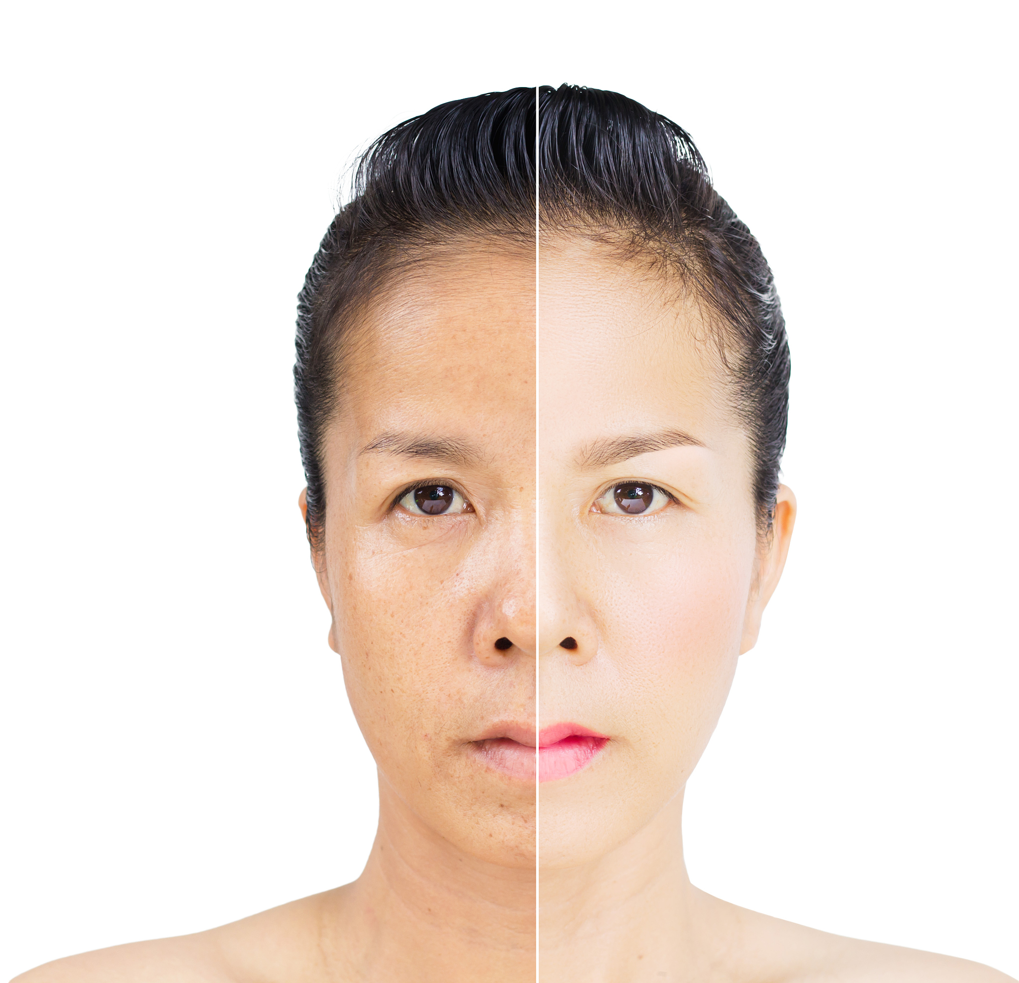 女生皮肤发黄的原因：从遗传到生活习惯，解析黄脸婆真相