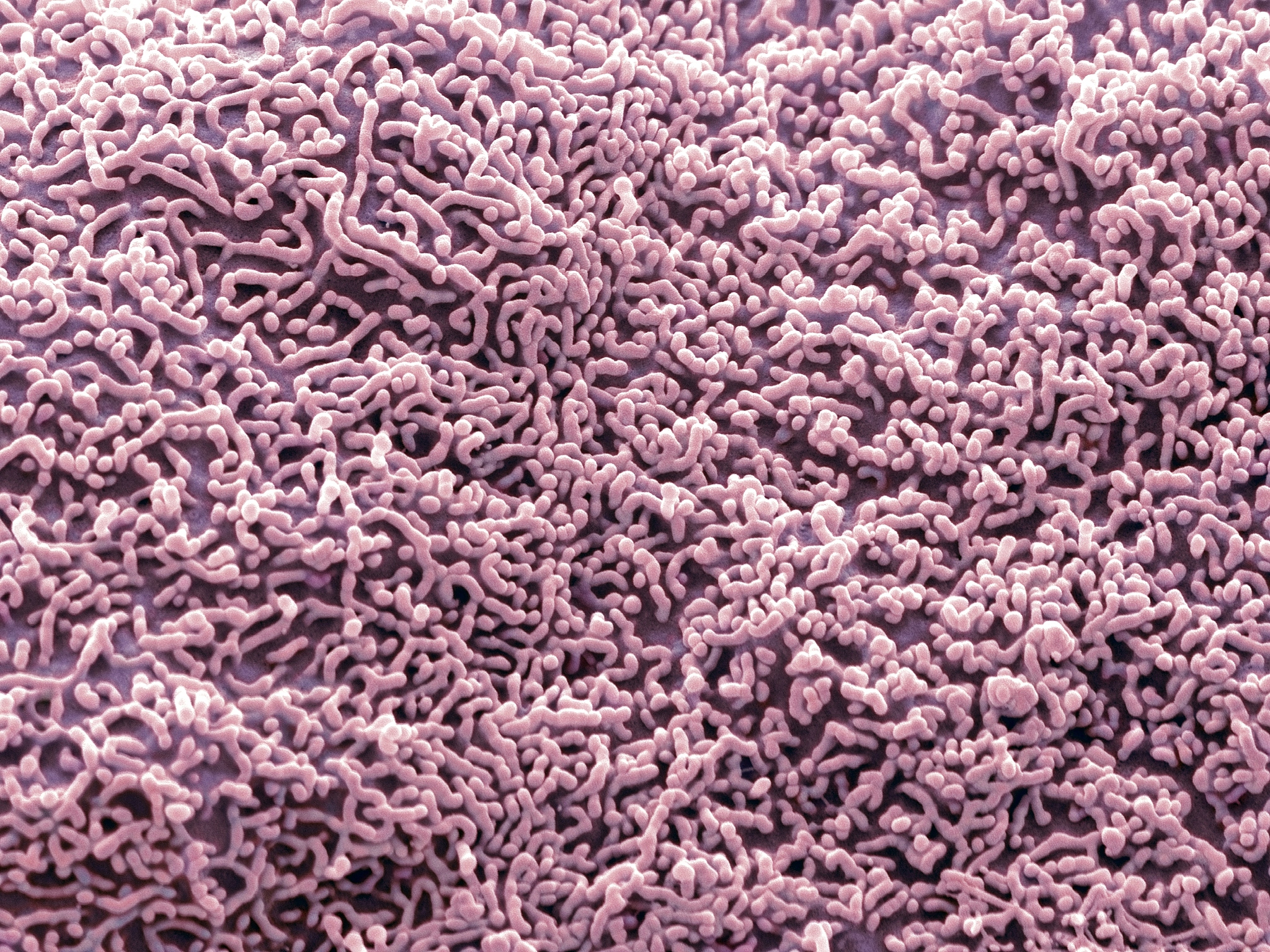 45岁女性尿频尿急3天，尿液分析报告解读：包含哪些检查项目？