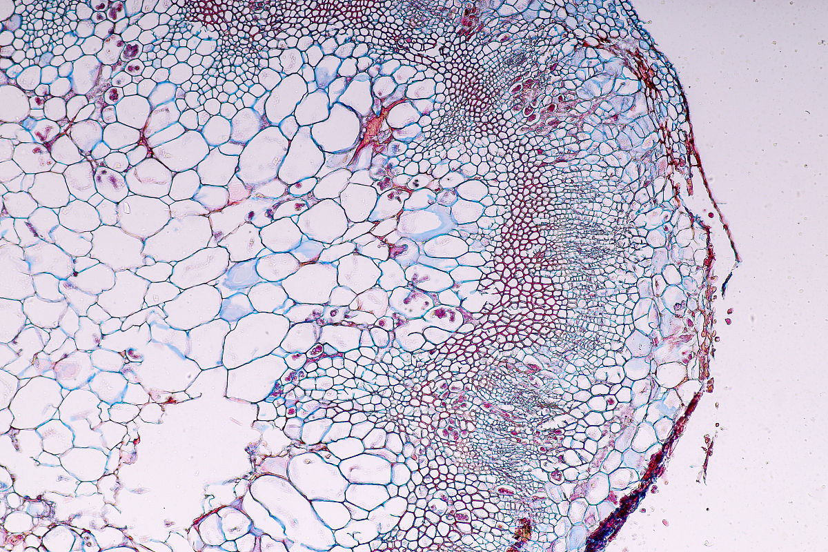 真菌门中无横隔壁菌丝的亚门