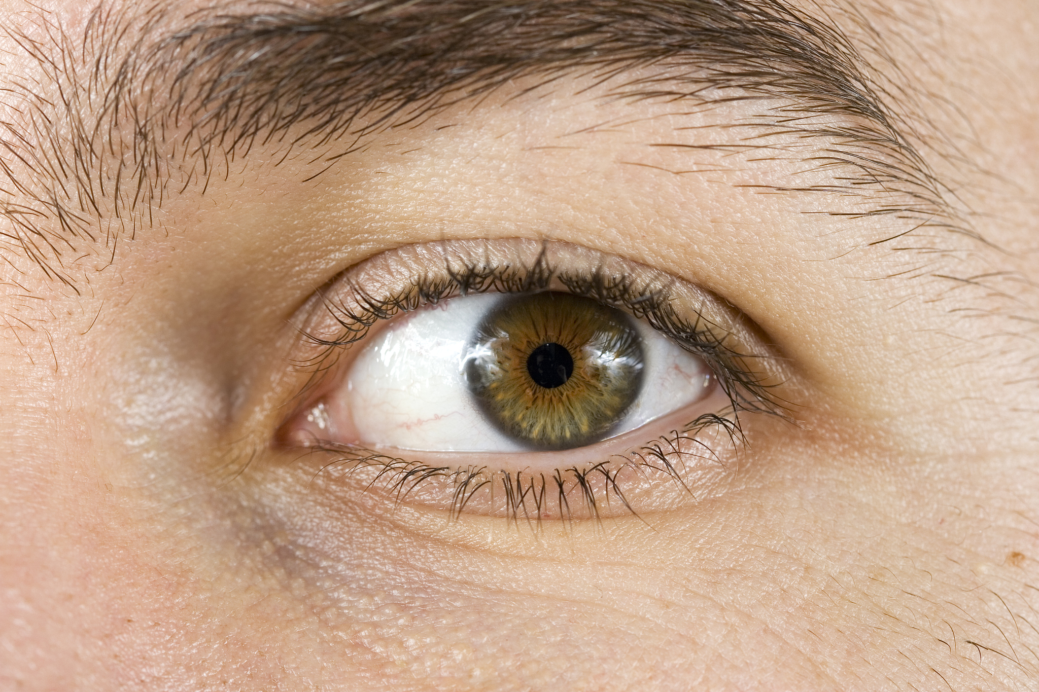 eyeball