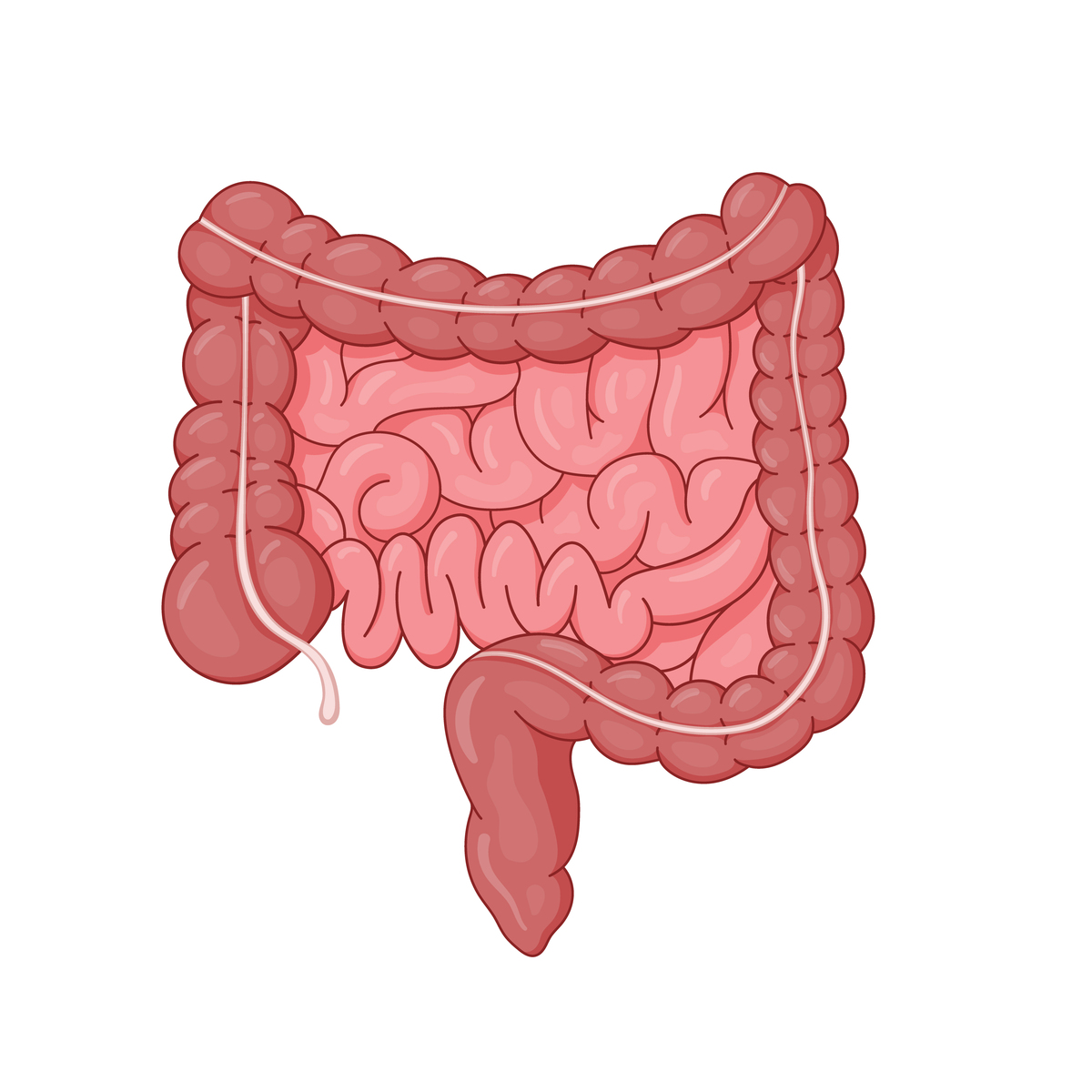 中医解释粘连性肠梗阻