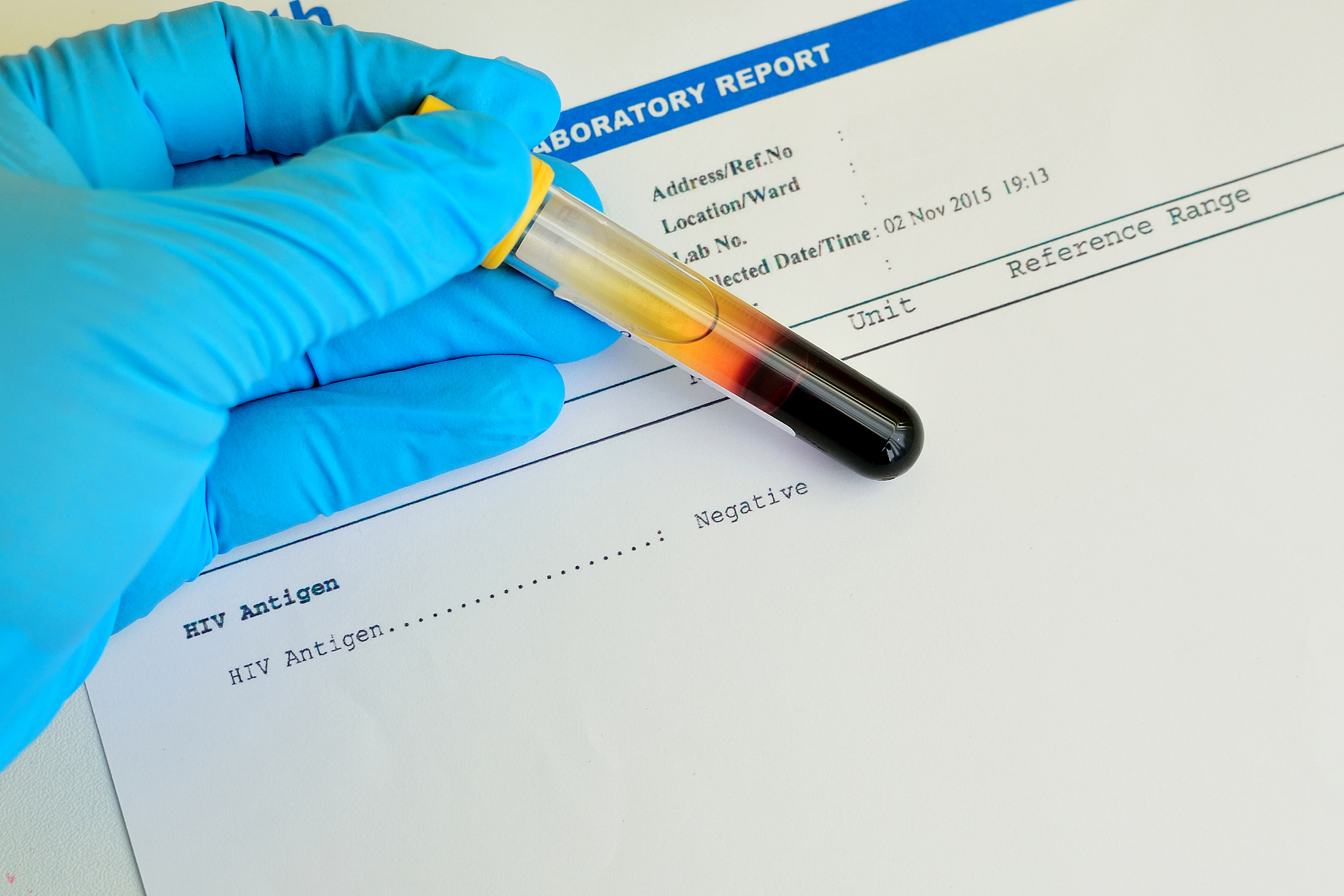 免疫组织化学(IHC)是什么？| 原理、步骤、应用