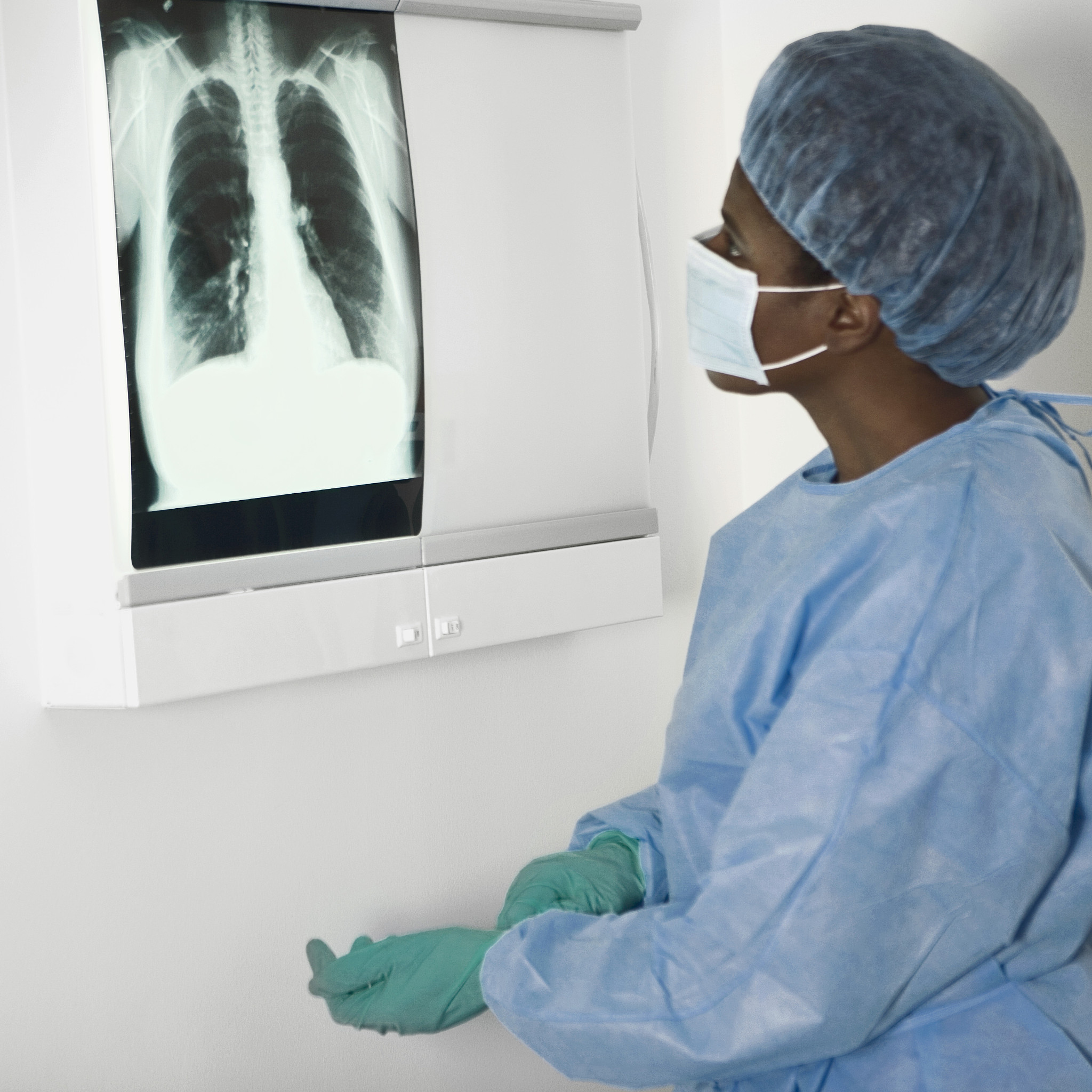 手术衣利润率揭秘：影响因素及行业概况