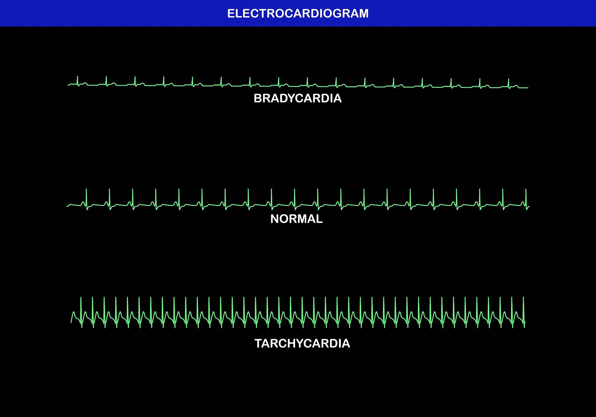 vsearch sintax_cutoff参数设置指南 - 优化您的序列比对