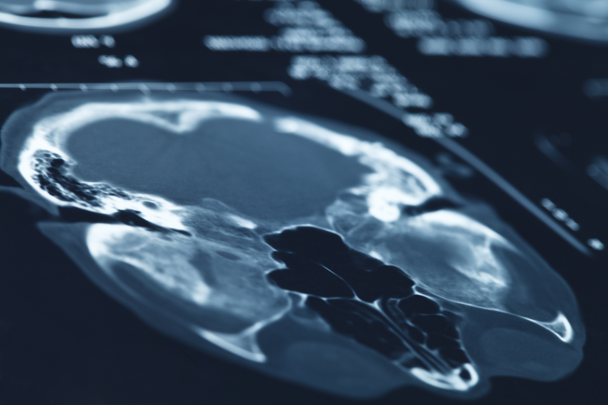 江苏宿豫中等专业学校2022年开设有哪些专业-怎么样