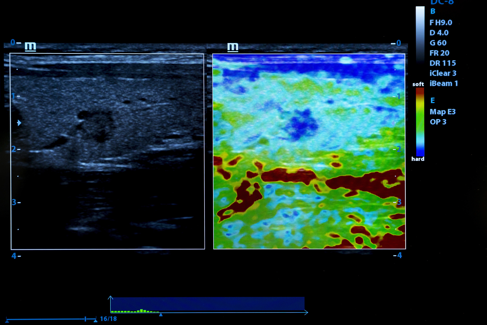超声成像技术现状：面临的挑战与机遇