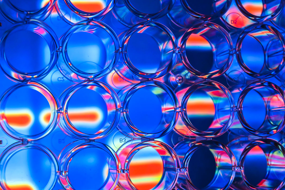 染色体片段的缺失和重复必然导致基因种类的变化