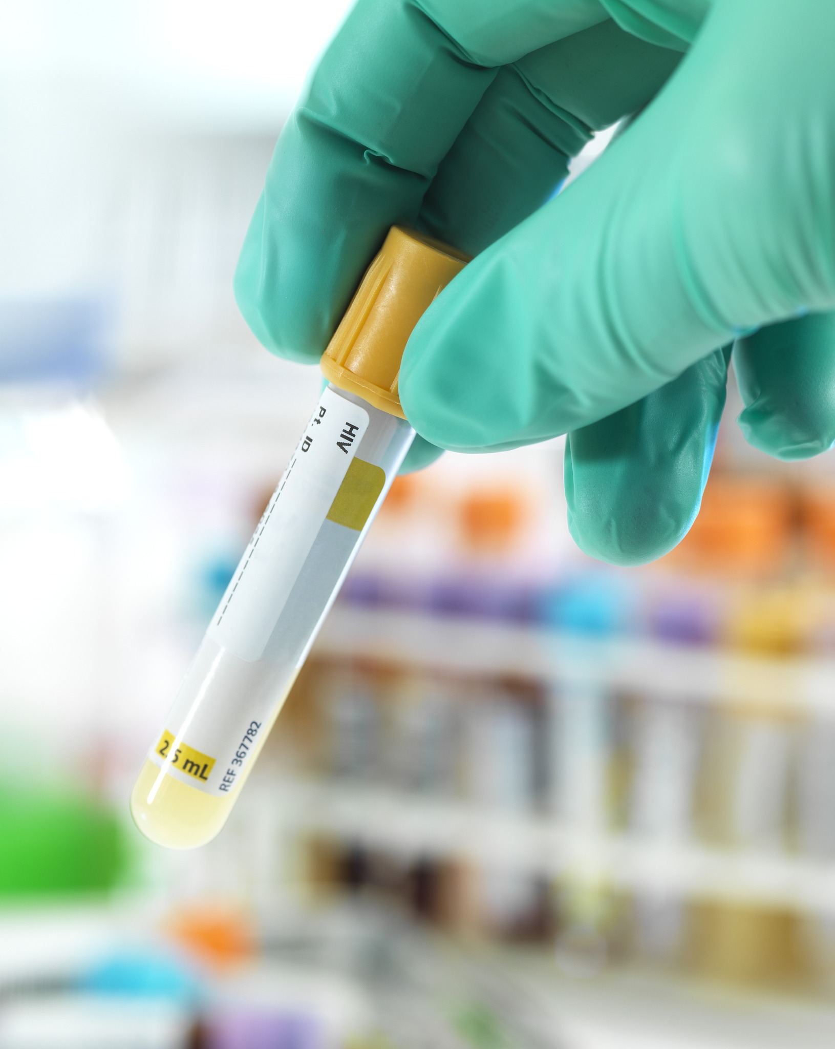 HIV患者可以做试管婴儿吗？