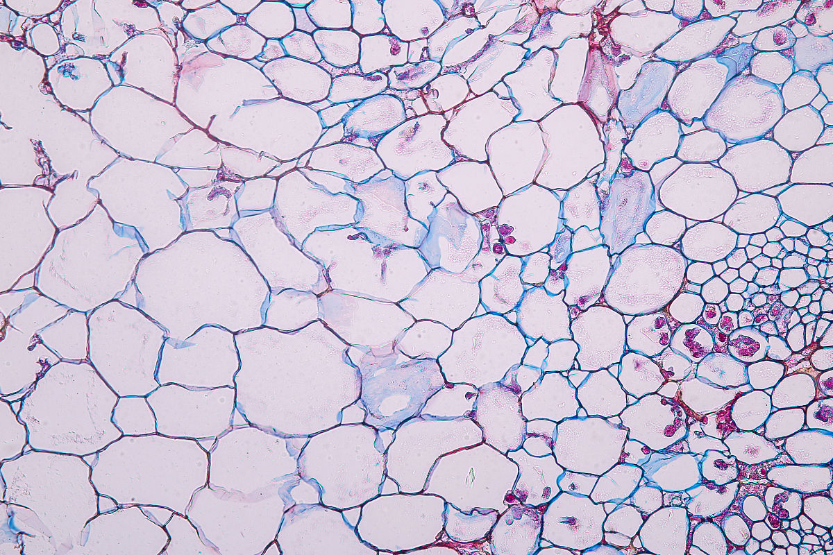 CUBIC 透明化技术：组织膨胀的原因和解决方案