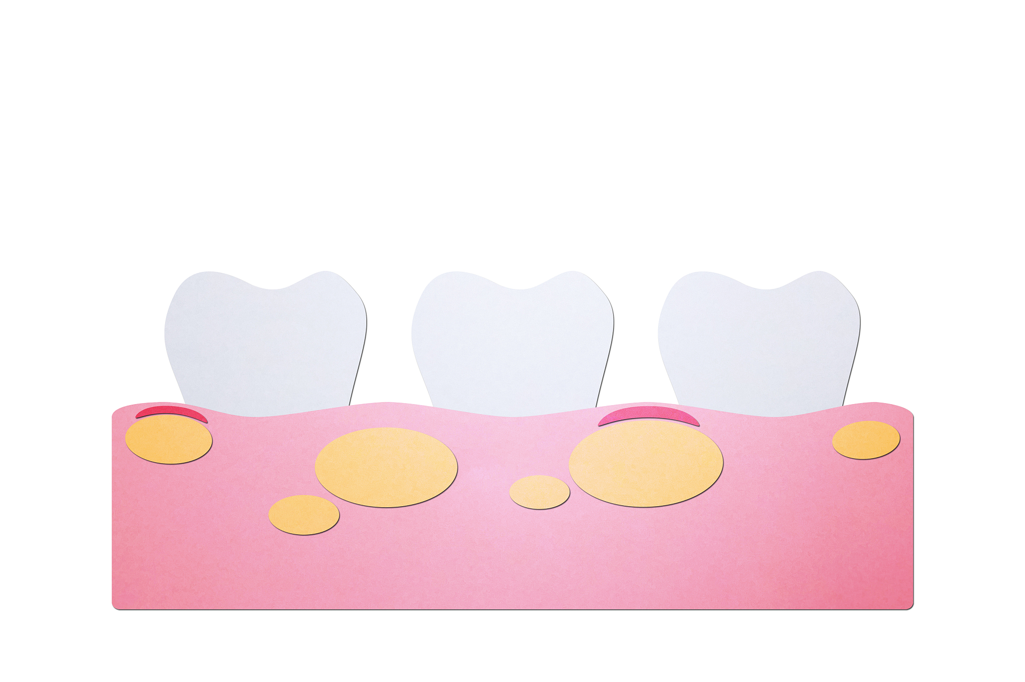 swollen gum pain symptom what is possible disease could it be diabete