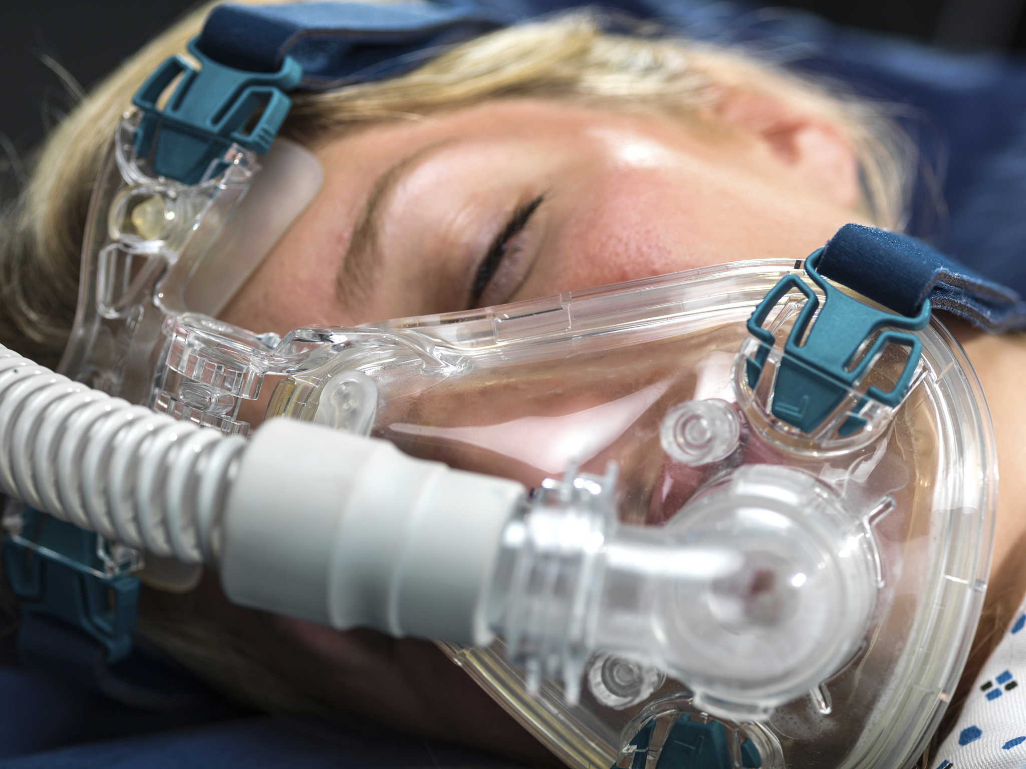 心肌梗死患者的氧流量