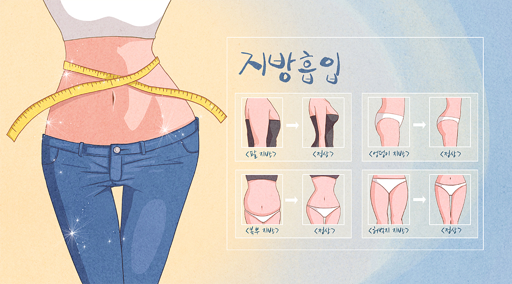 手臂脂肪环吸：告别拜拜肉，重塑纤细手臂！