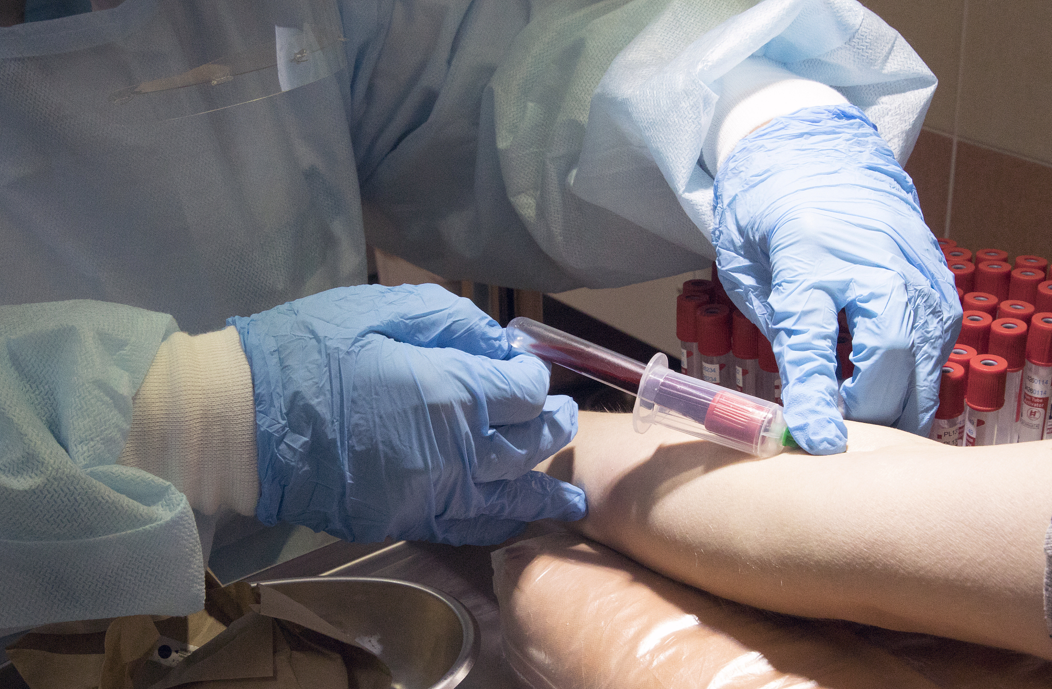 关节镜修复外侧副韧带：微创、快速恢复，适合青少年和女性