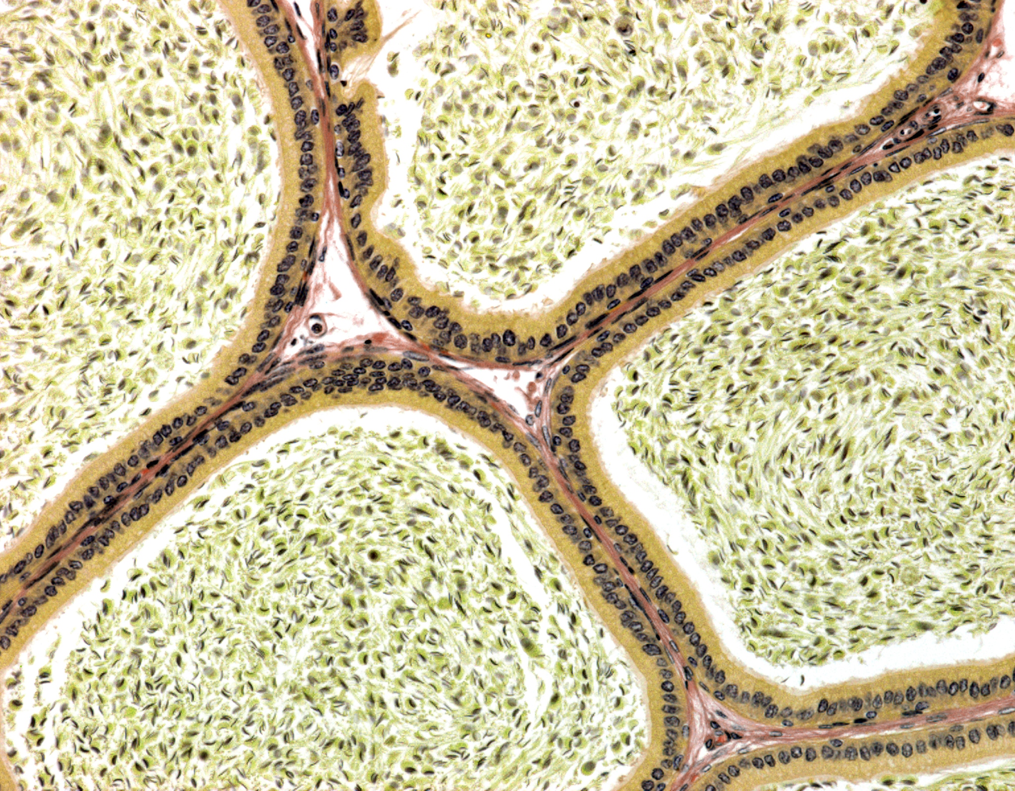 小鼠海马和大脑皮层组织切片制备: 与H&E染色切片流程一致