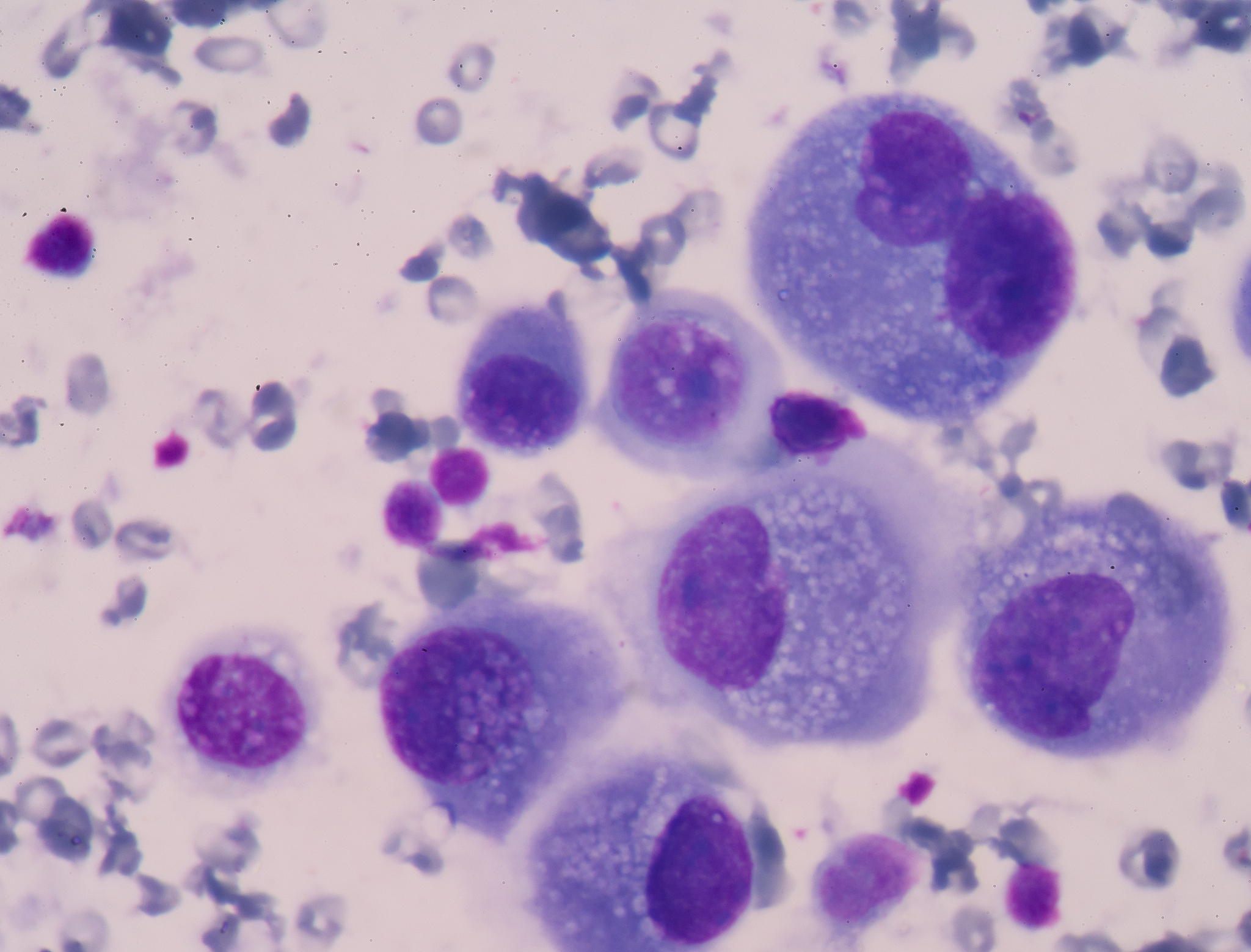 Western Blot vs. IHC: 肿瘤浸润评估的最佳方法是什么？