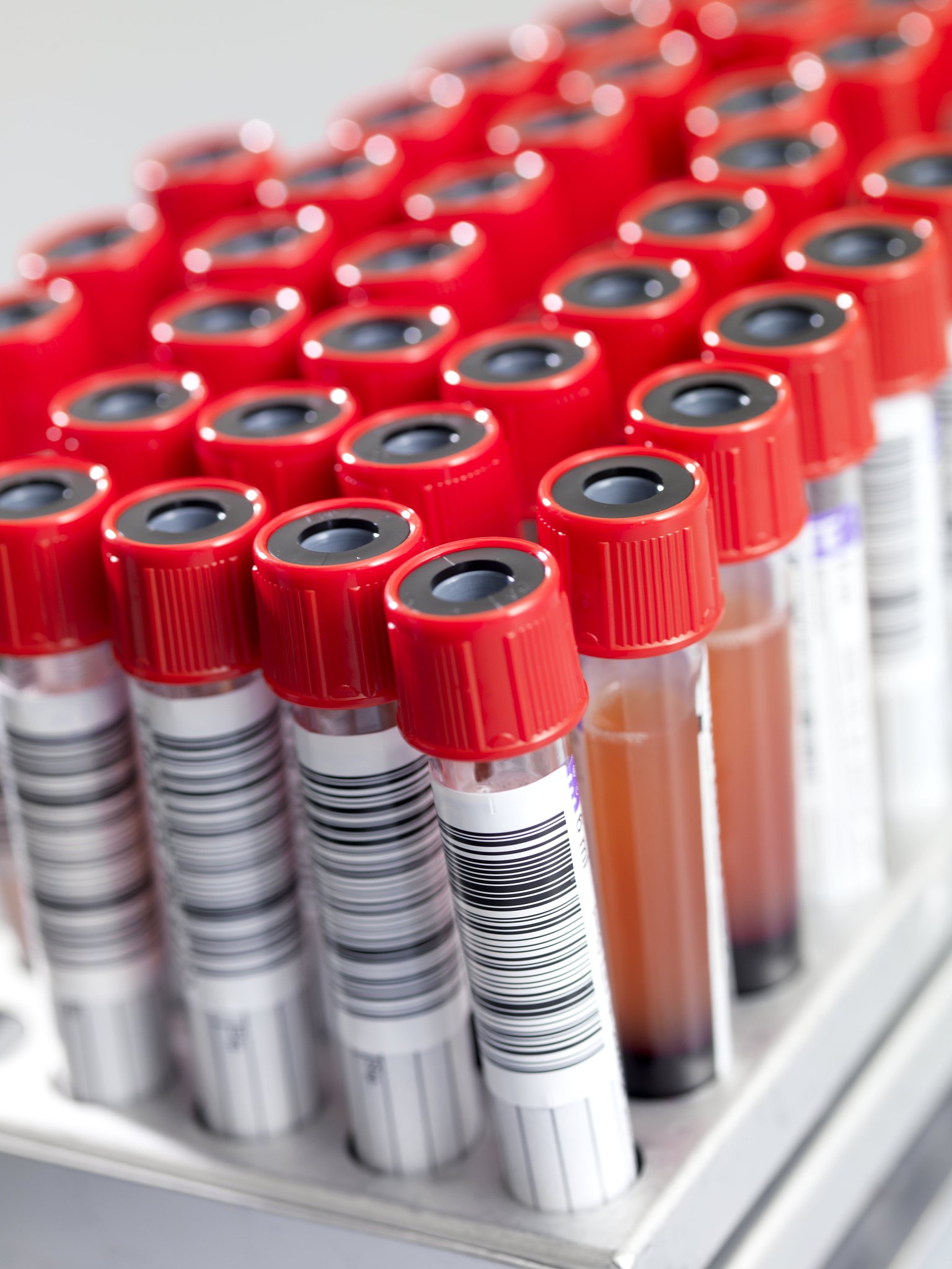 Fluorescent Imaging Reveals Mouse Blood Perfusion in Human Blood Vessels Within Grafts