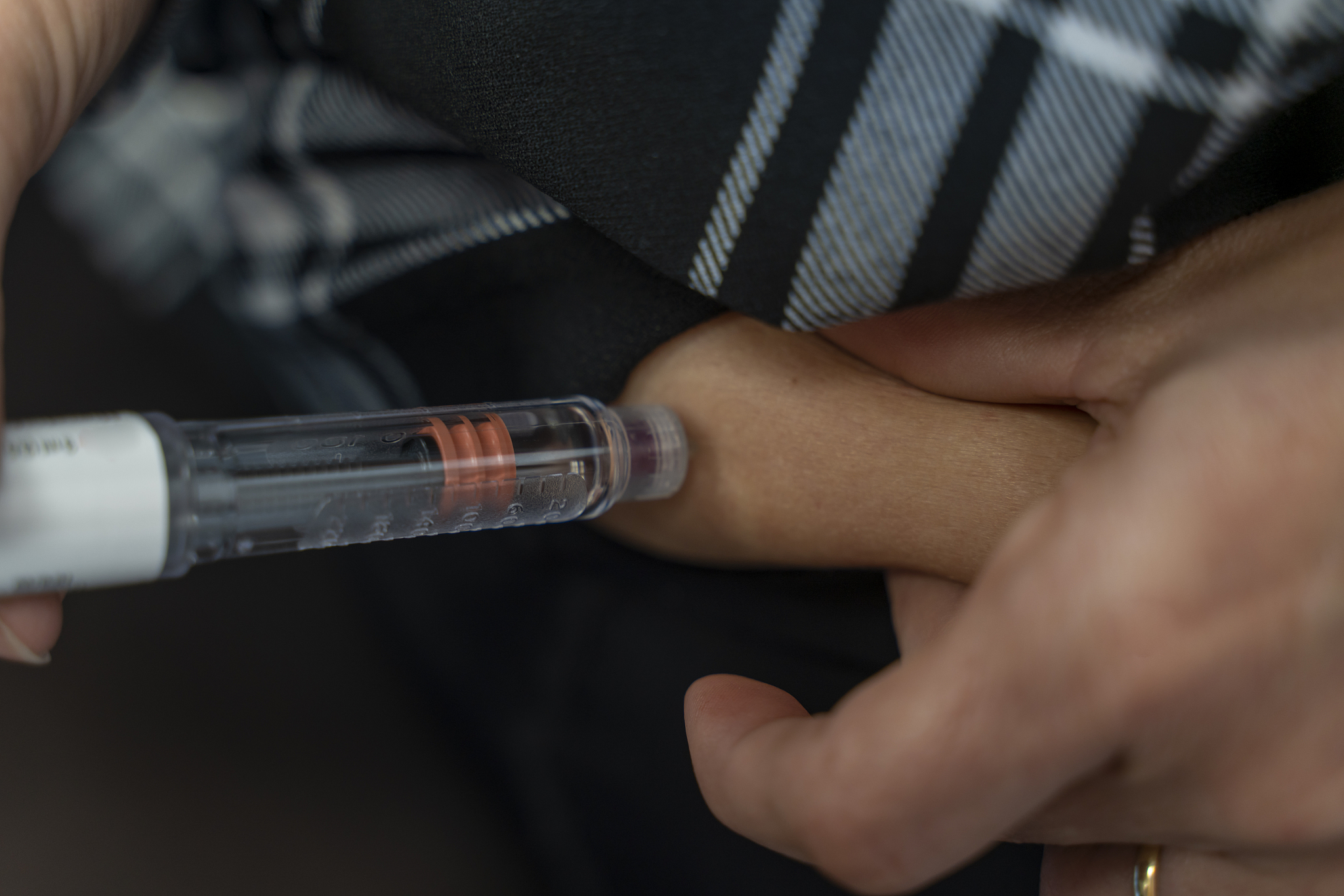 胰岛素笔注射与皮肤成