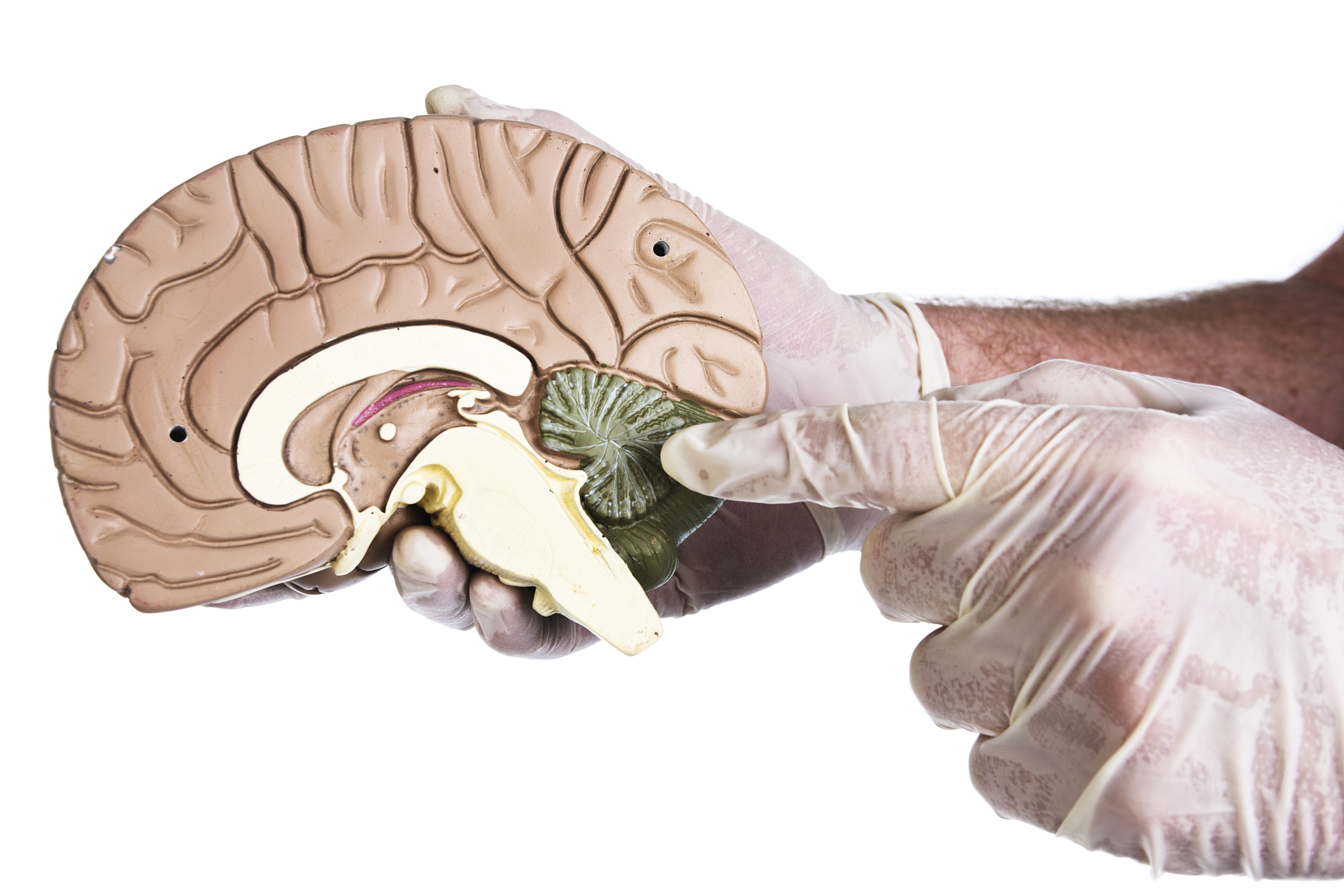 二分类任务中的敏感性 (Sensitivity) 和特异性 (Specificity) 解释