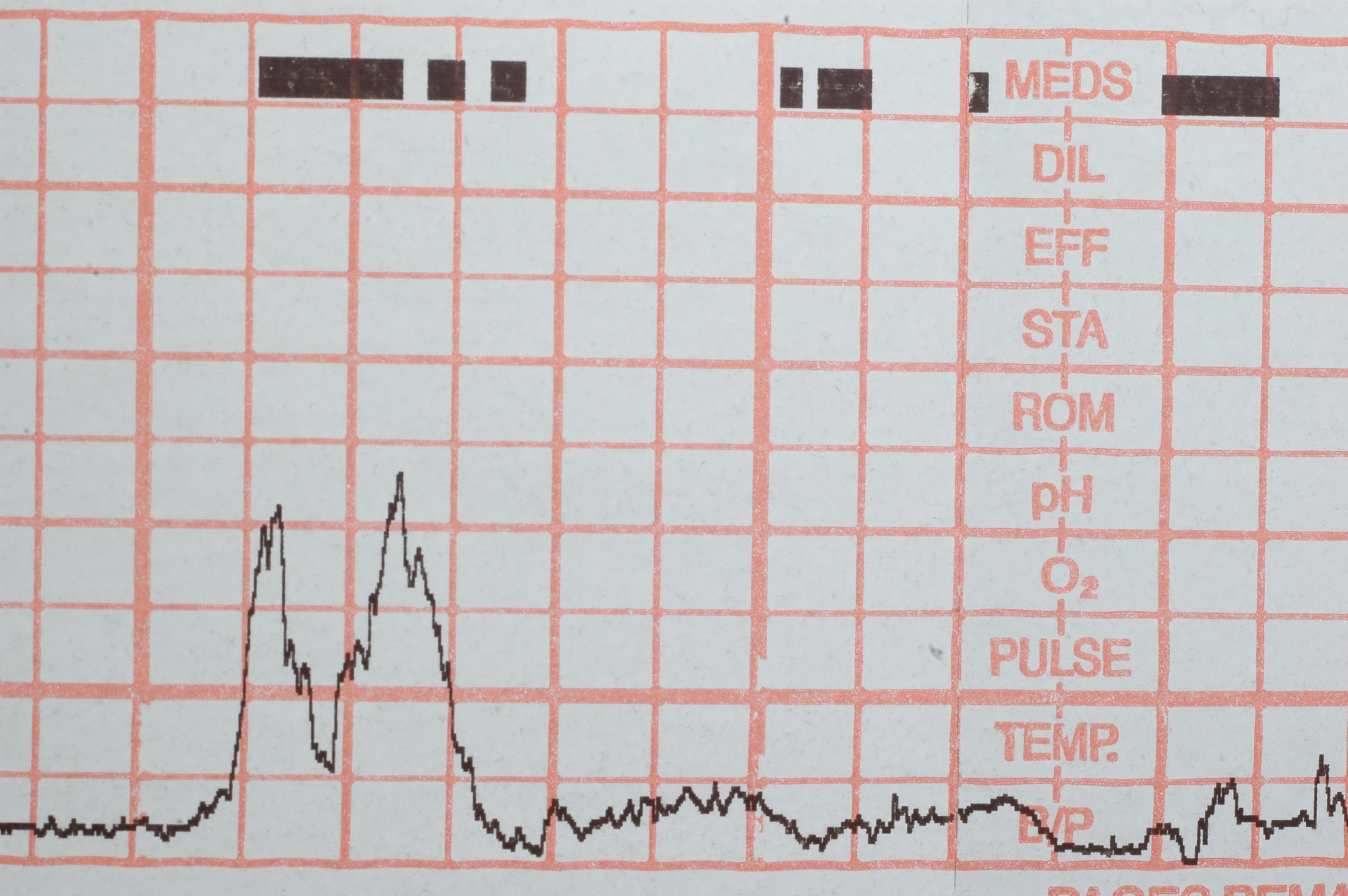 把PWM 或 SMBus 接口的数据信号通常模式下从该管脚通过 PWM输出物体温度降重