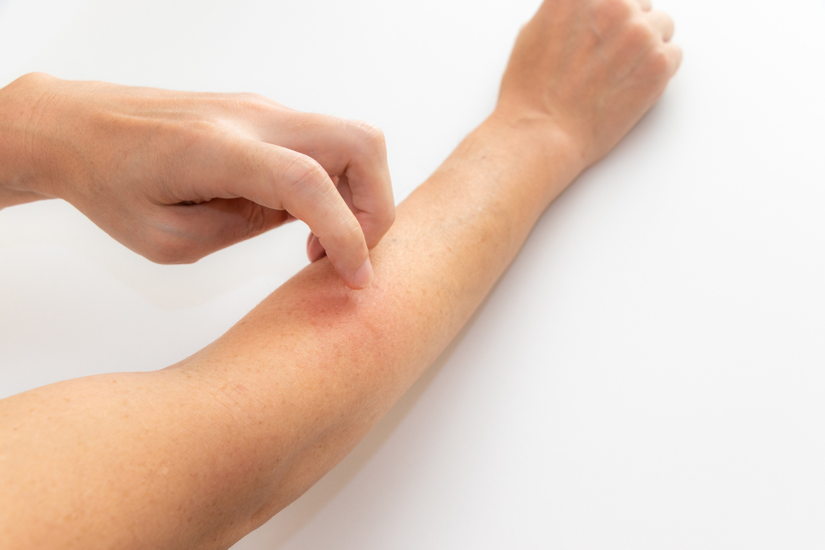 身上痒，挠了为什么还痒？缓解奇招大揭秘！