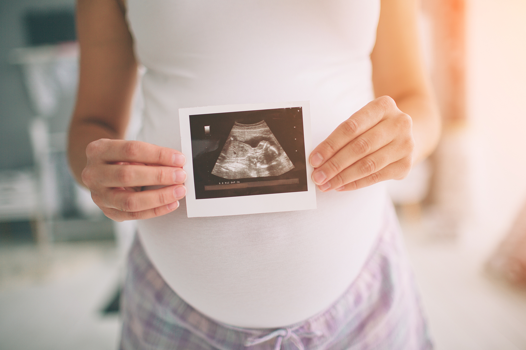 pregnant woman holding ultrasound scan. concept of pregnancy hea