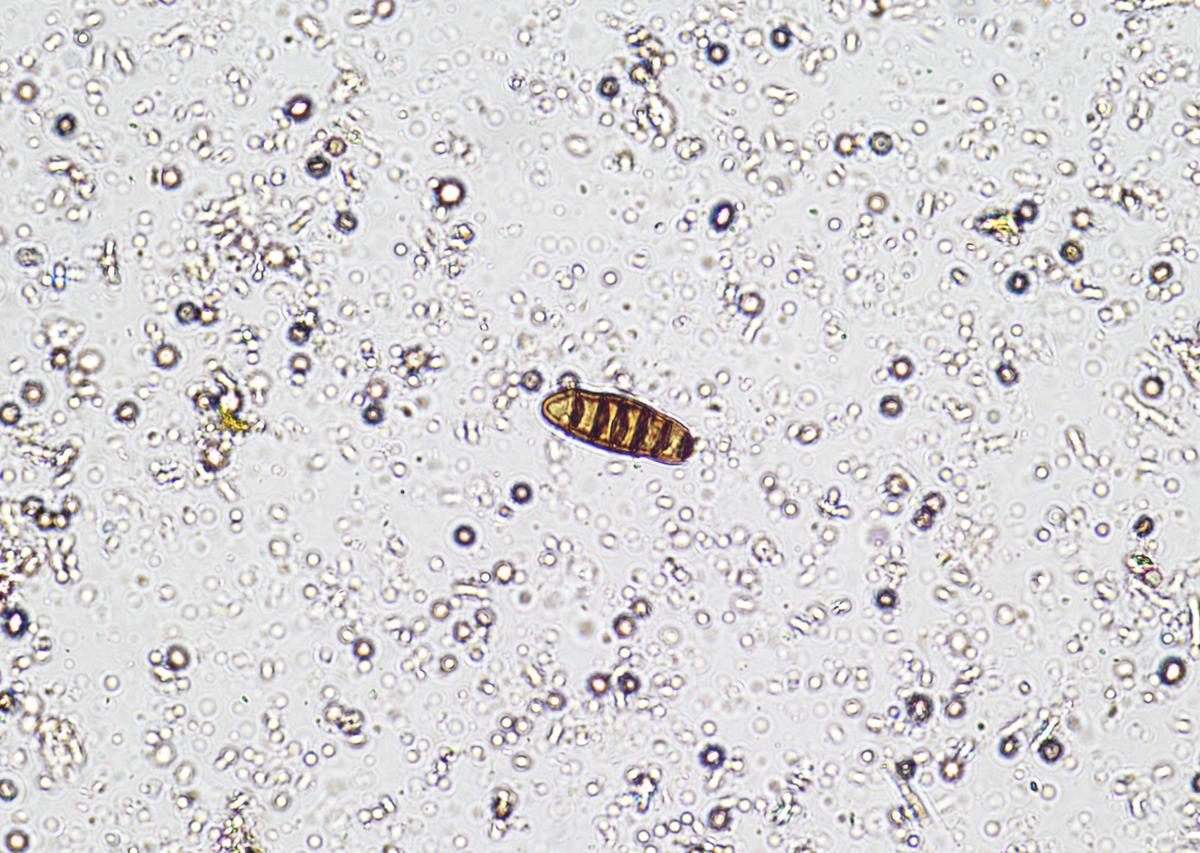 翻译For example temperature fluctuation had significant impacts on the relative abundances of the major phyla in both the bacterial and fungal communities while increased mean temperature had no signifi