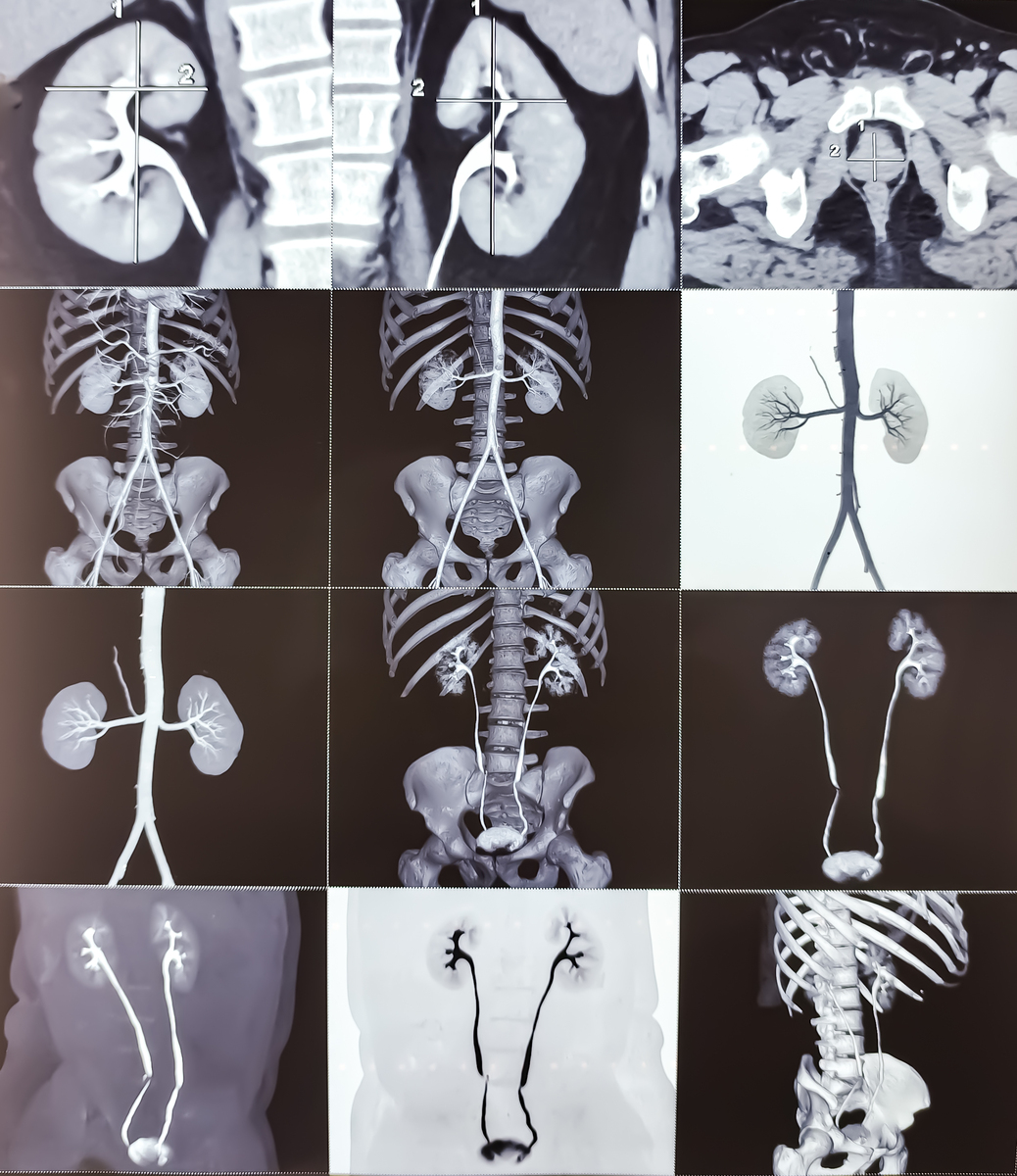 计算机断层成像技术