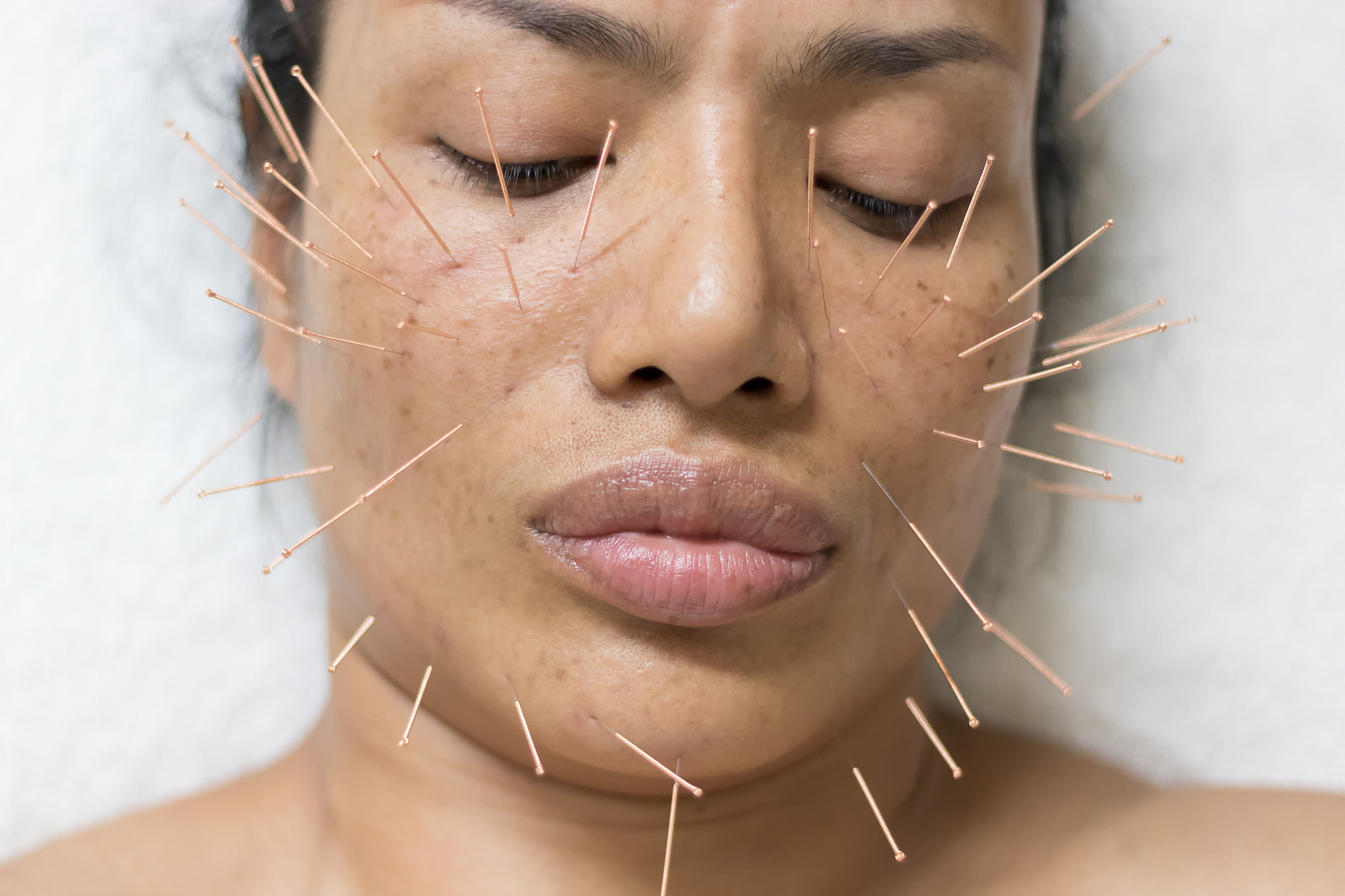 asian women 40 years old acupuncture acupuncture on face to main