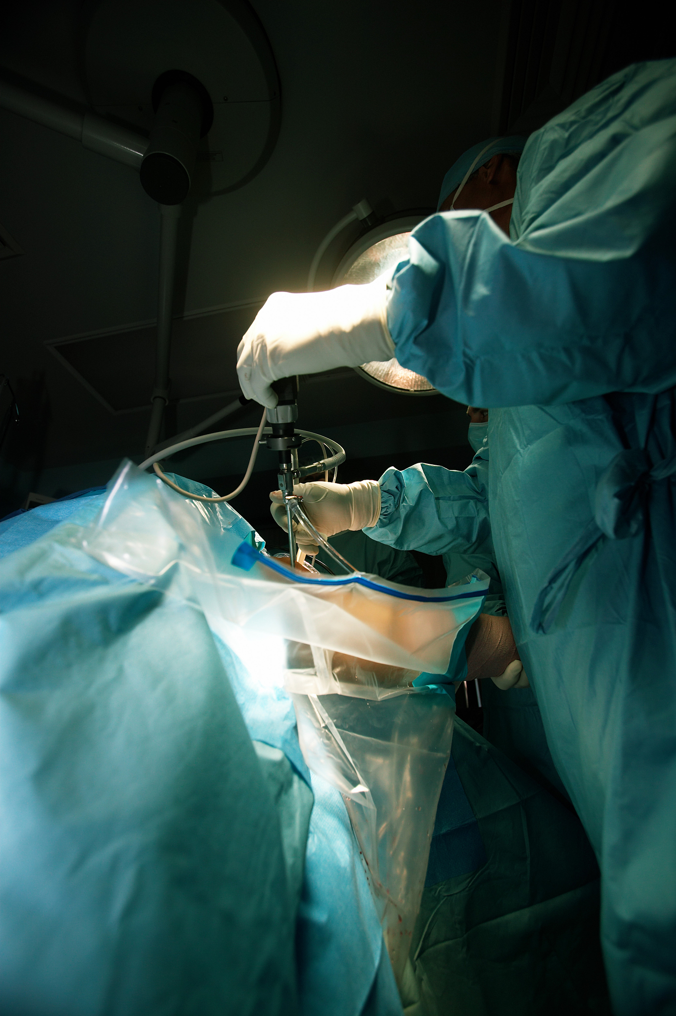 surgeon performing knee surgery