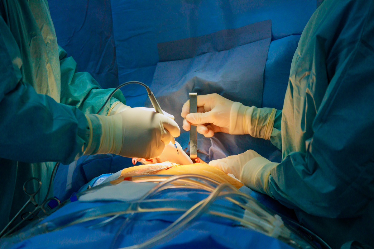 妇科腹腔镜手术是什么？优势、风险及适应症全面解析
