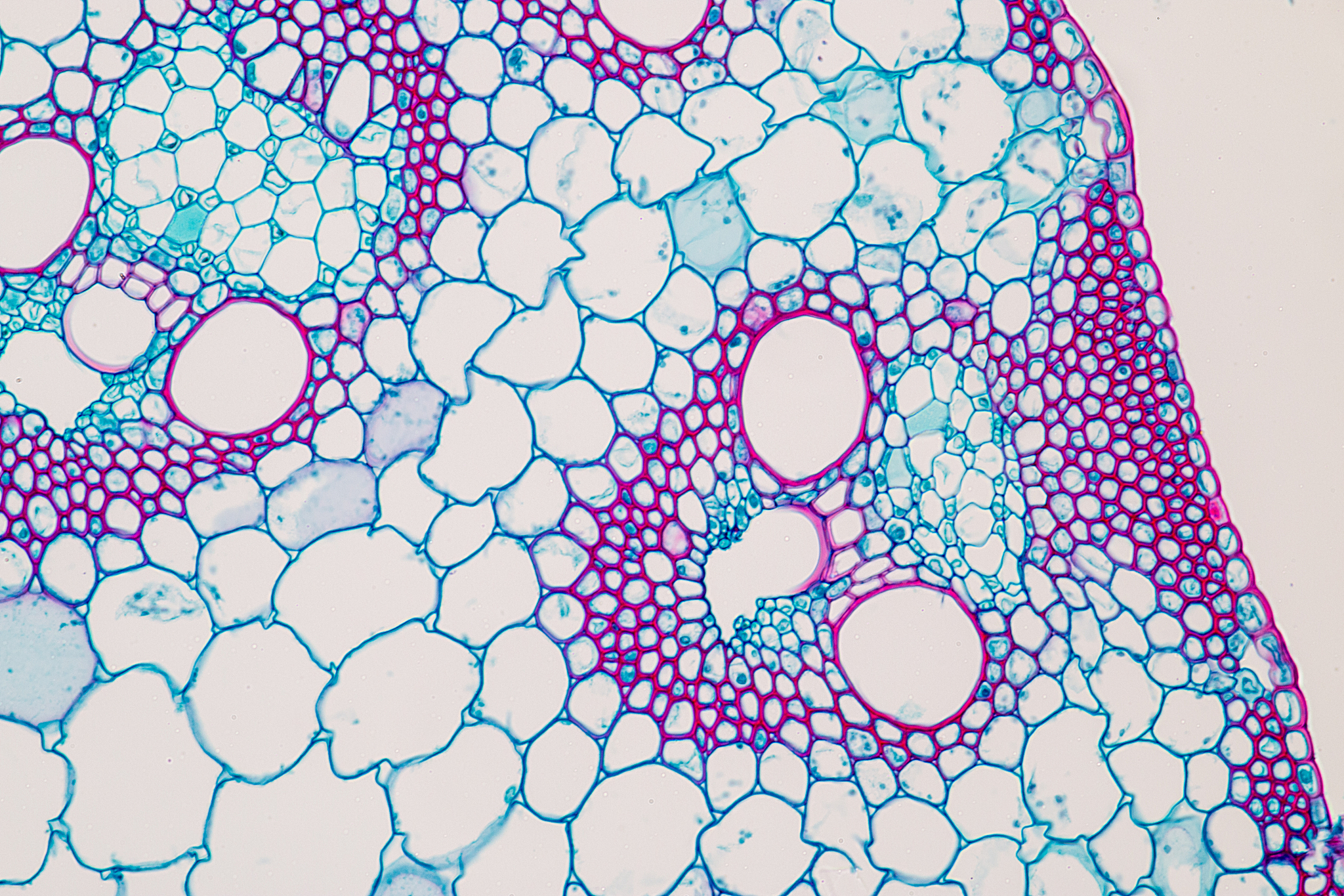 次生木质部：定义与解释