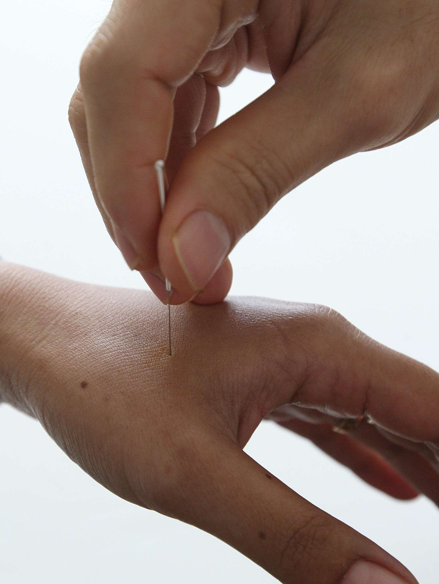 贵州护理职业技术学院中医康复技术专业怎么样都要学些什么内容