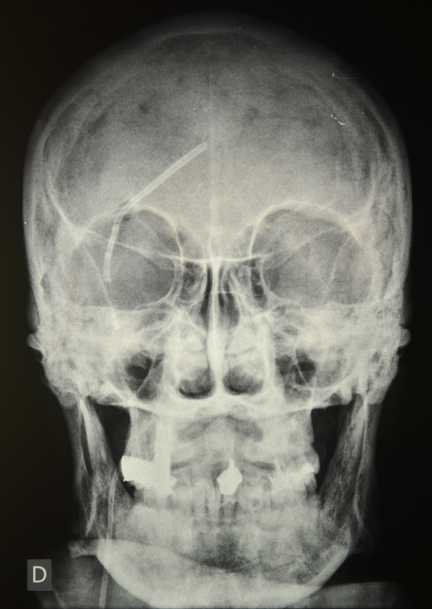 World Neurosurgery期刊推荐理由？