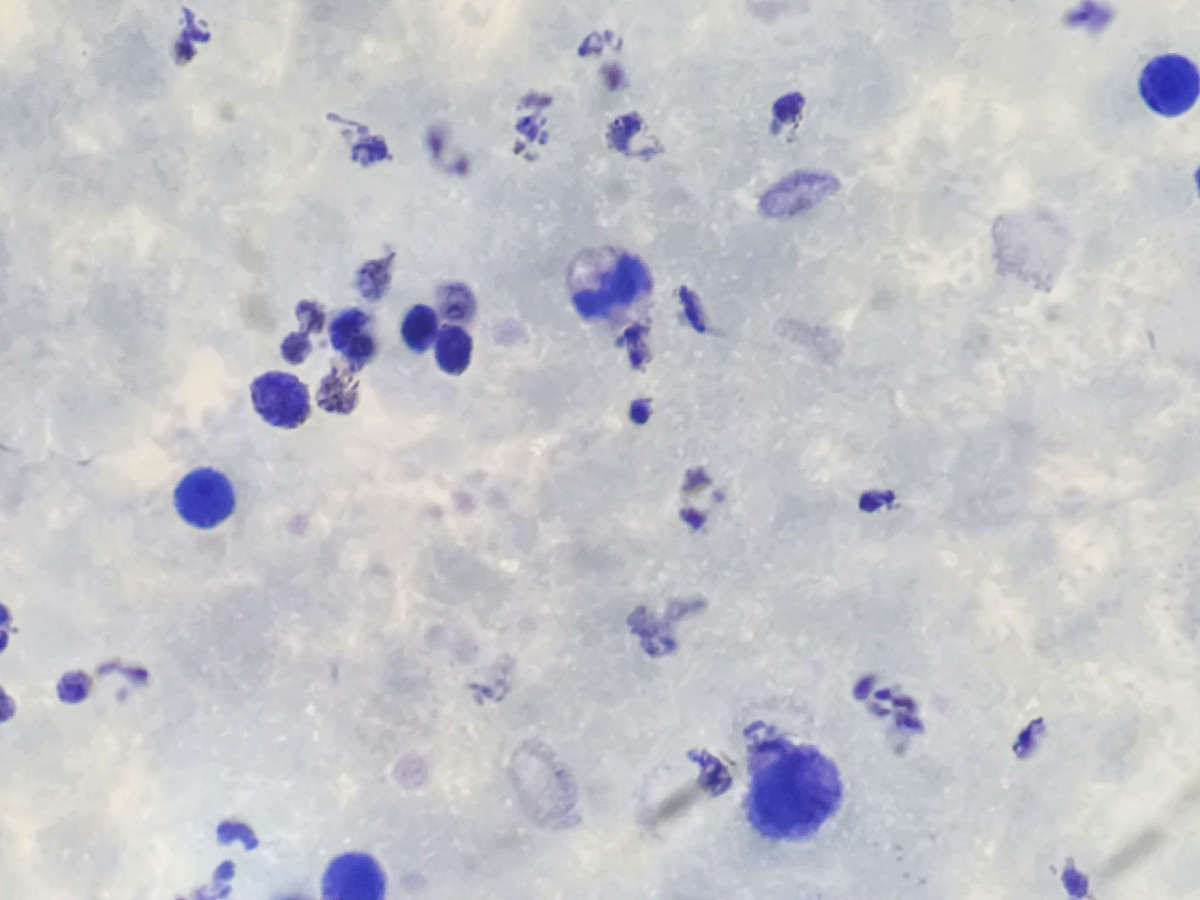 金黄色葡萄球菌诱导小鼠产生IL-4：免疫调节与感染治疗新视角