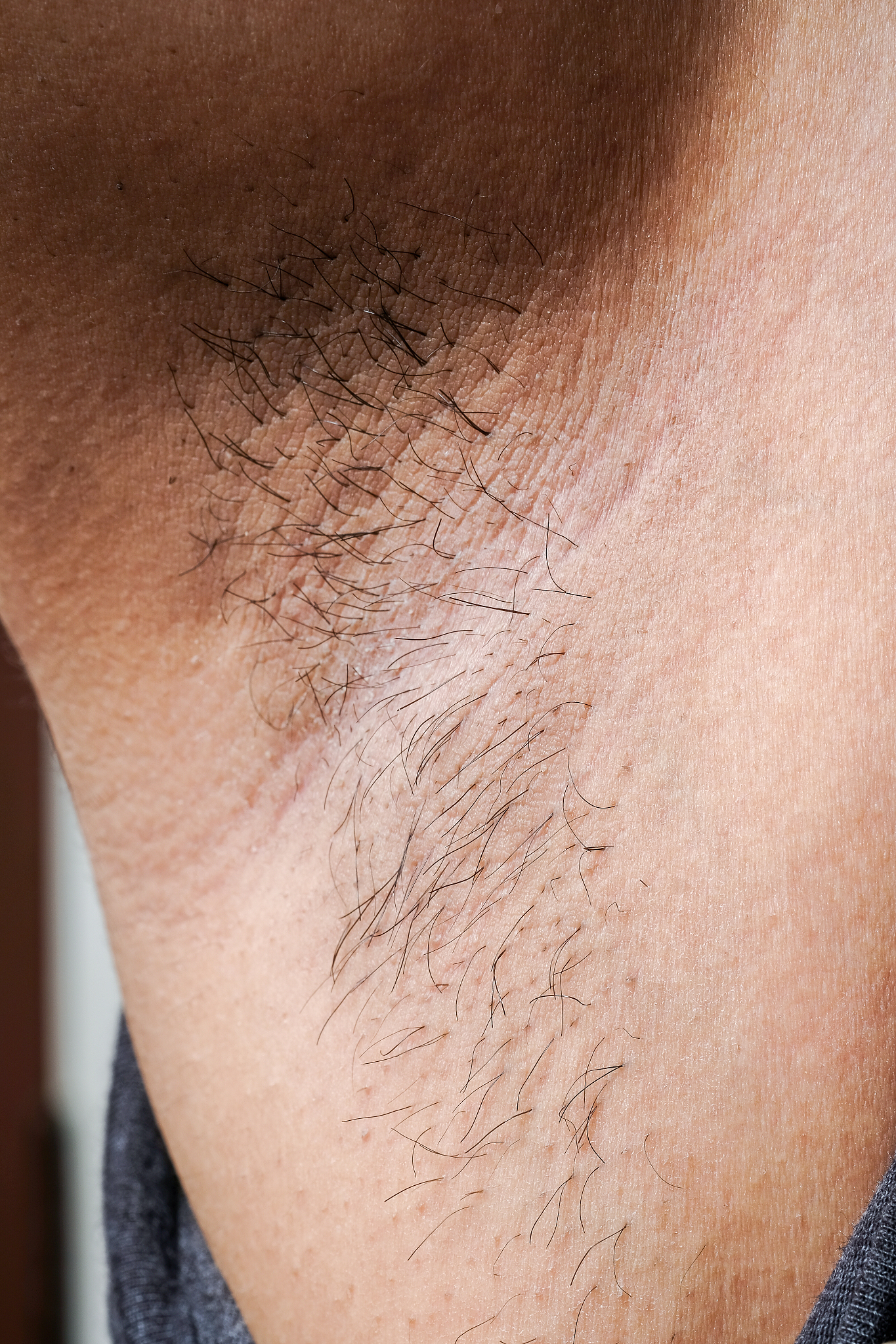armpit hair women