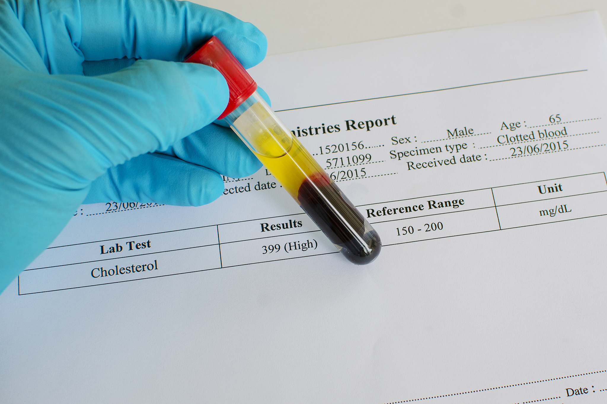 番茄红素软胶囊降血脂？功效解析及注意事项