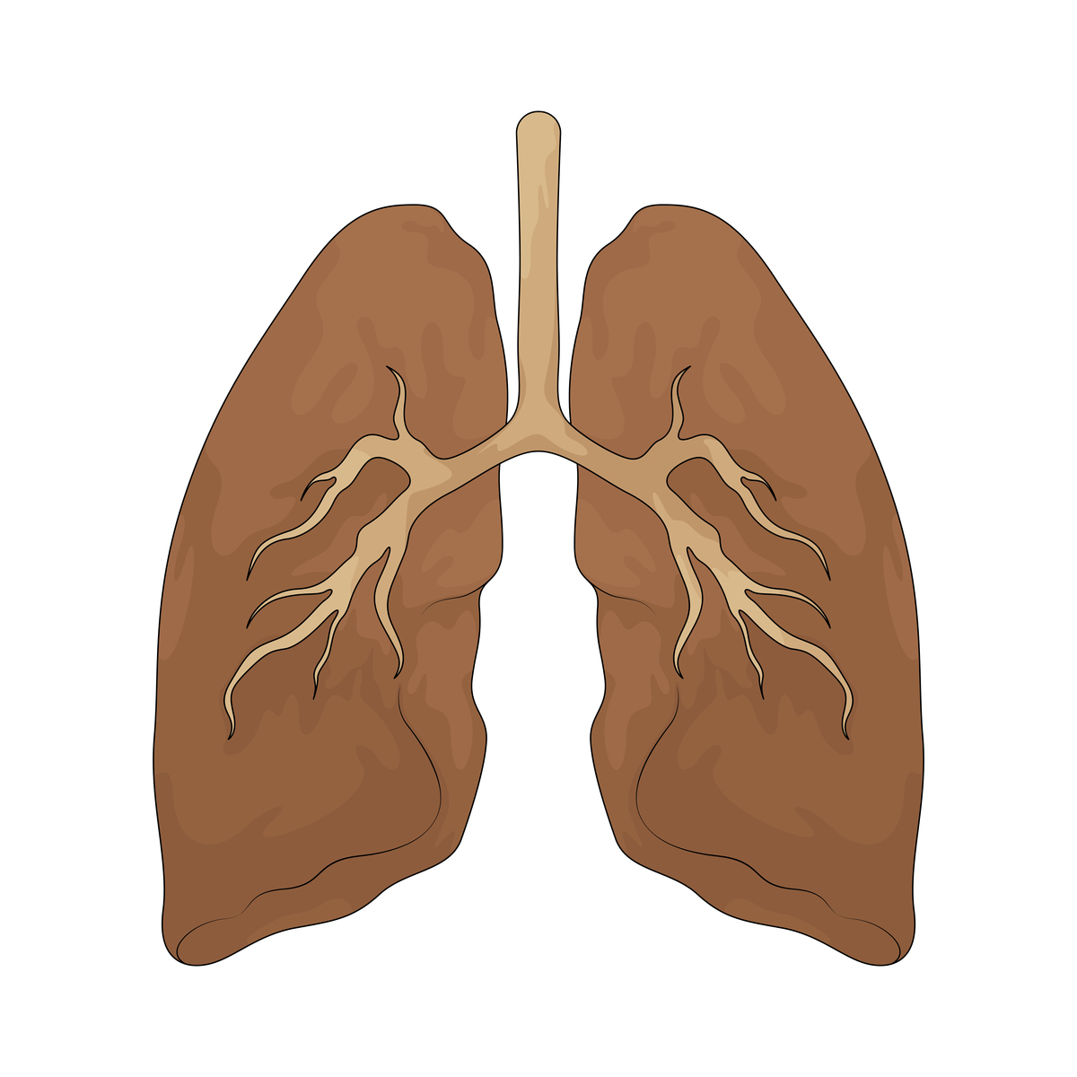 给以下文案写一个标题党的标题肺结节一定会变成肺癌吗？离肺癌还有多远呢？我们不能仅仅以结节的大小来判断它的危险程度医生也无法一眼看出是良性还是恶性这也导致许多患者对小结节是否为肿瘤产生怀疑。要确定是否属于高风险人群首先要看是否符合以下条件：长期吸烟每年吸烟超过30包；患有肺气肿、慢性阻塞性肺病、间质性肺炎等肺部疾病；从事与化工厂、煤矿、切割大理石等相关职业或长期居住在相关场所附近接触石棉、砷、铍、镉