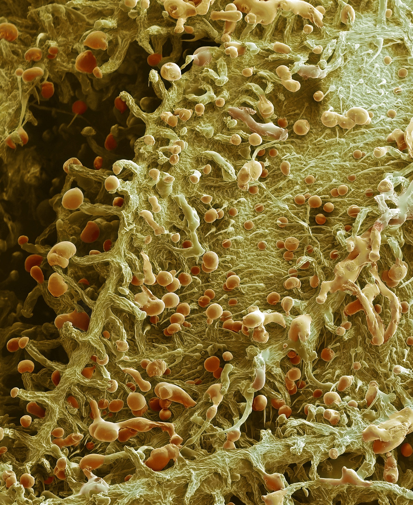 硫酸盐还原菌在重金属污染生物修复中的应用及机制