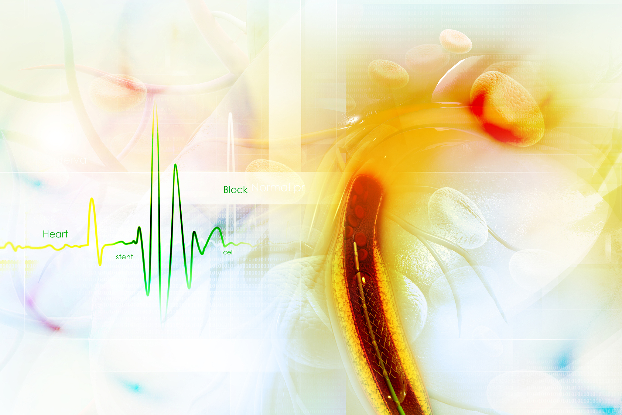 非症状性颅内动脉狭窄：诊断、风险与治疗研究热点